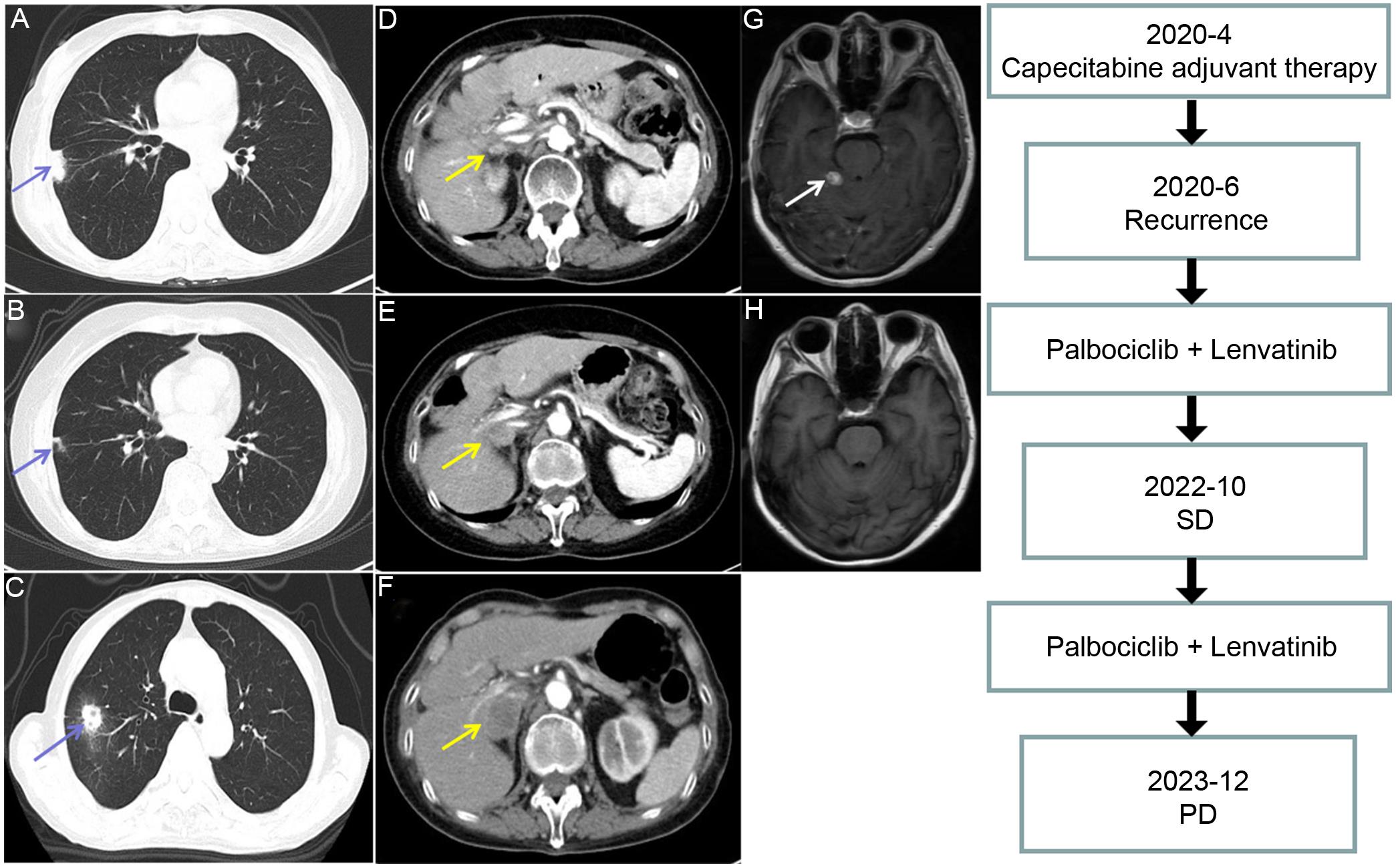 Images of the patient during treatment.