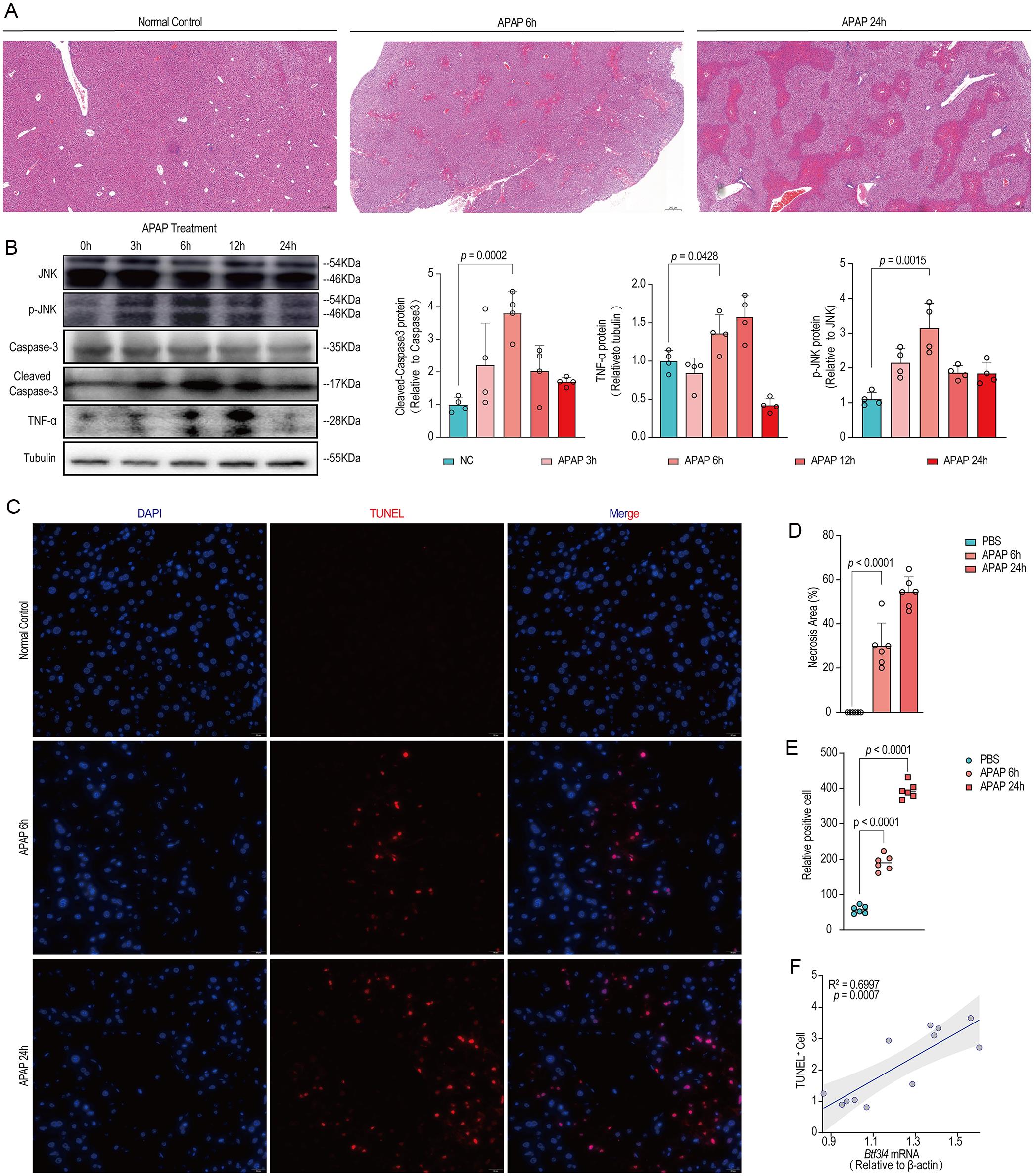 BTF3L4 protein expression is positively correlated with hepatic injury in APAP-induced mouse model of liver injury.