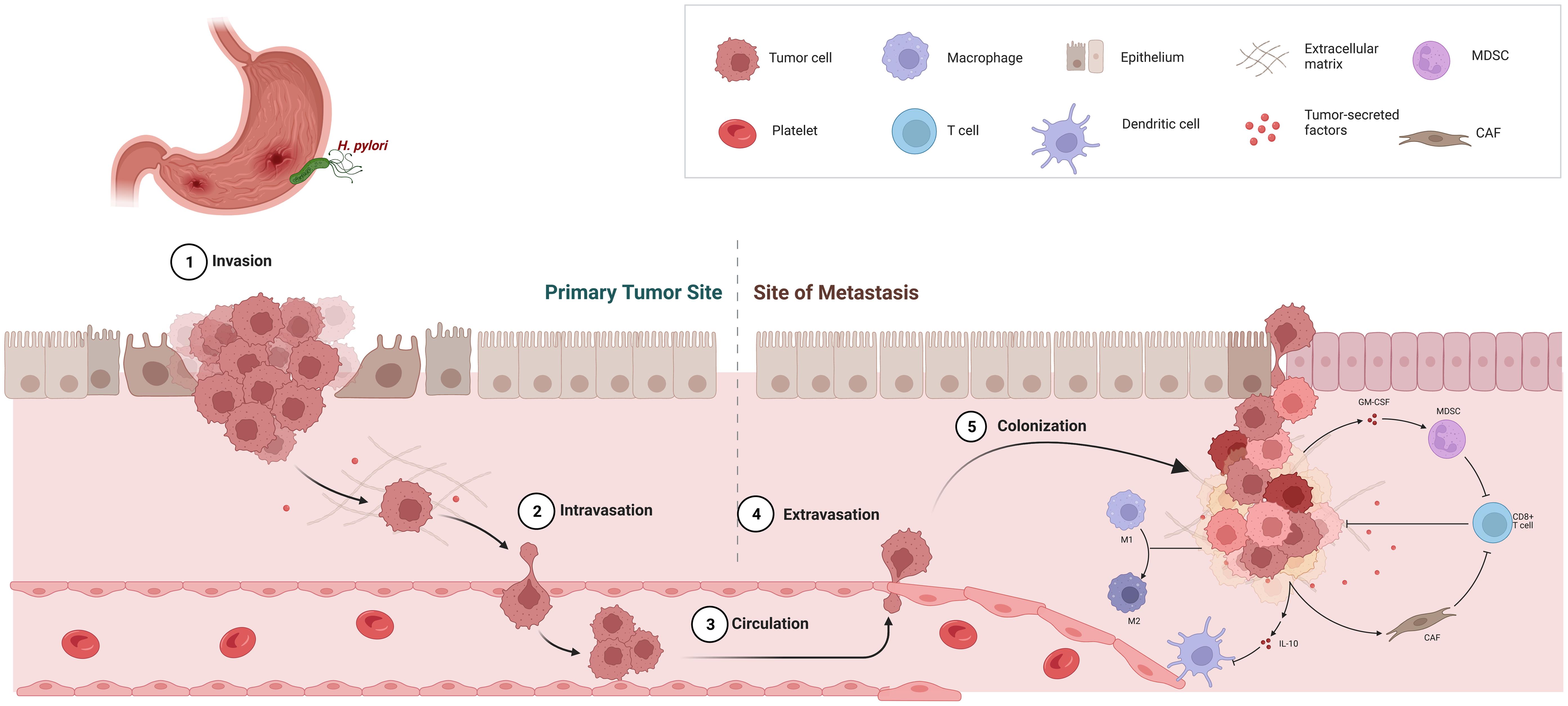Overview of metastasis and TME.