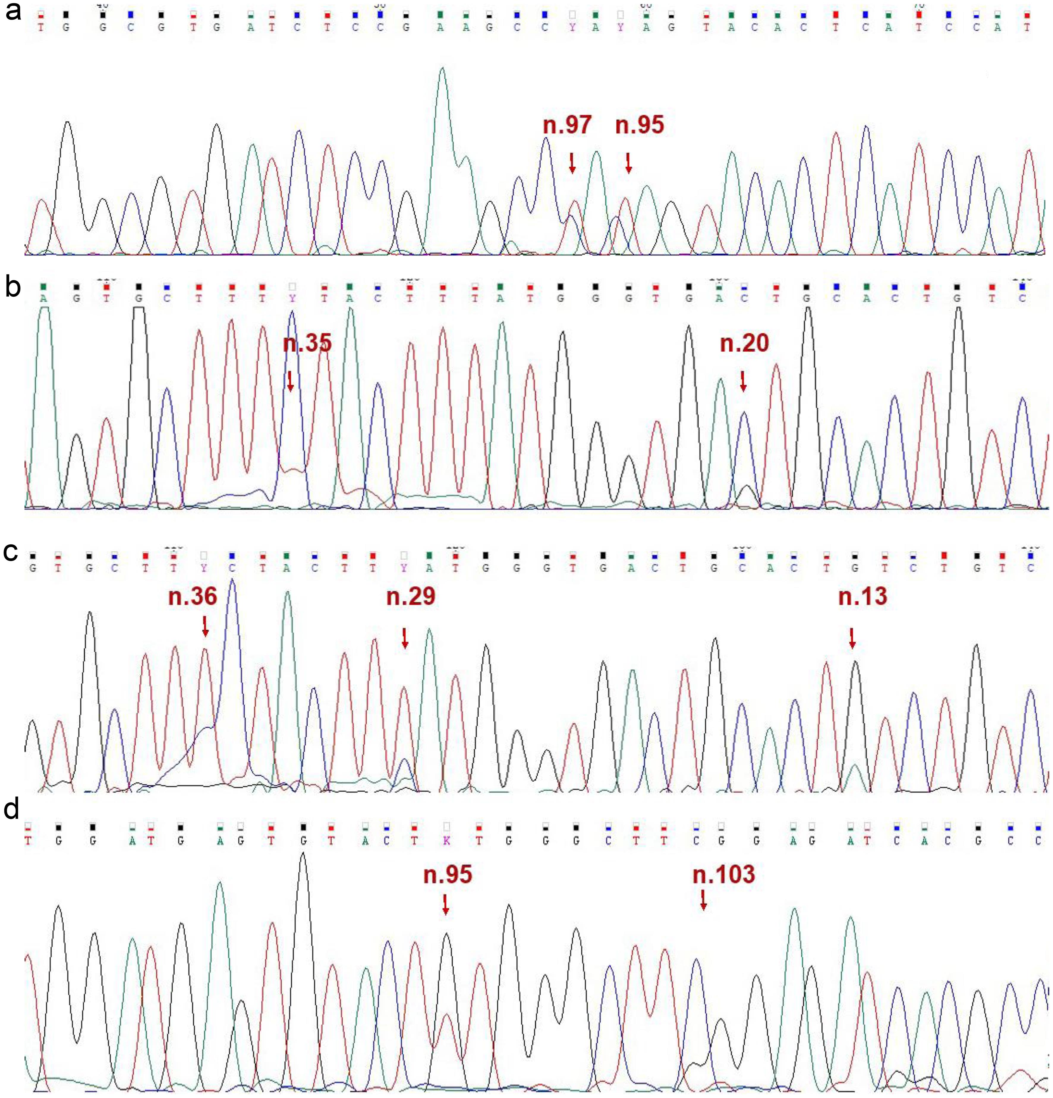 Fragments of the sequence chromatogram obtained using a reverse primer of DNA samples containing mutations n.95G/A and n.97G/A (a); n.20G/C and n.35G/A (b); n.13C/T, n.29A/G and n.36A/G (c); and fragment of the sequence chromatogram obtained using a forward primer of a DNA sample containing mutations n.95G/T and n.113C/G (d) in the <italic>MIR142</italic> gene.