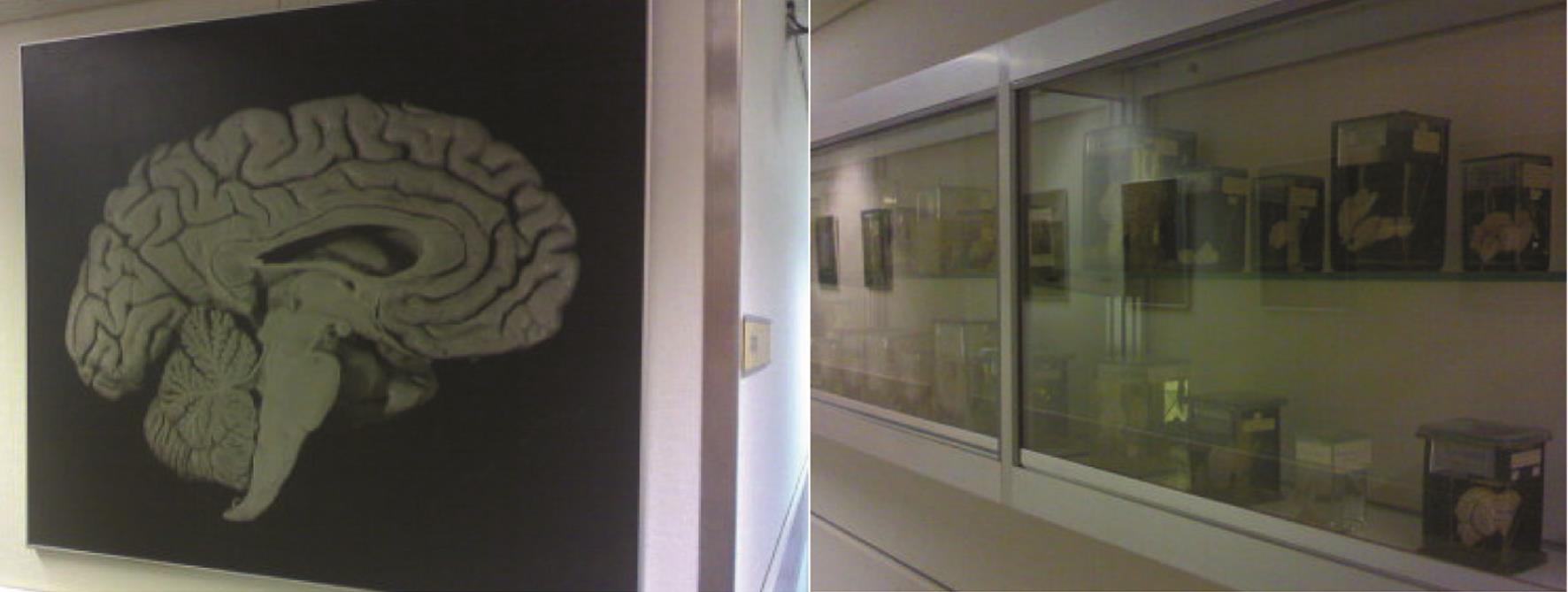 人脑矢状切面图，不需要修饰，本身就是一个艺术作品了（左）；橱窗上摆放的各种形态的动物神经系统实物标本，又是一件件艺术作品（右）。