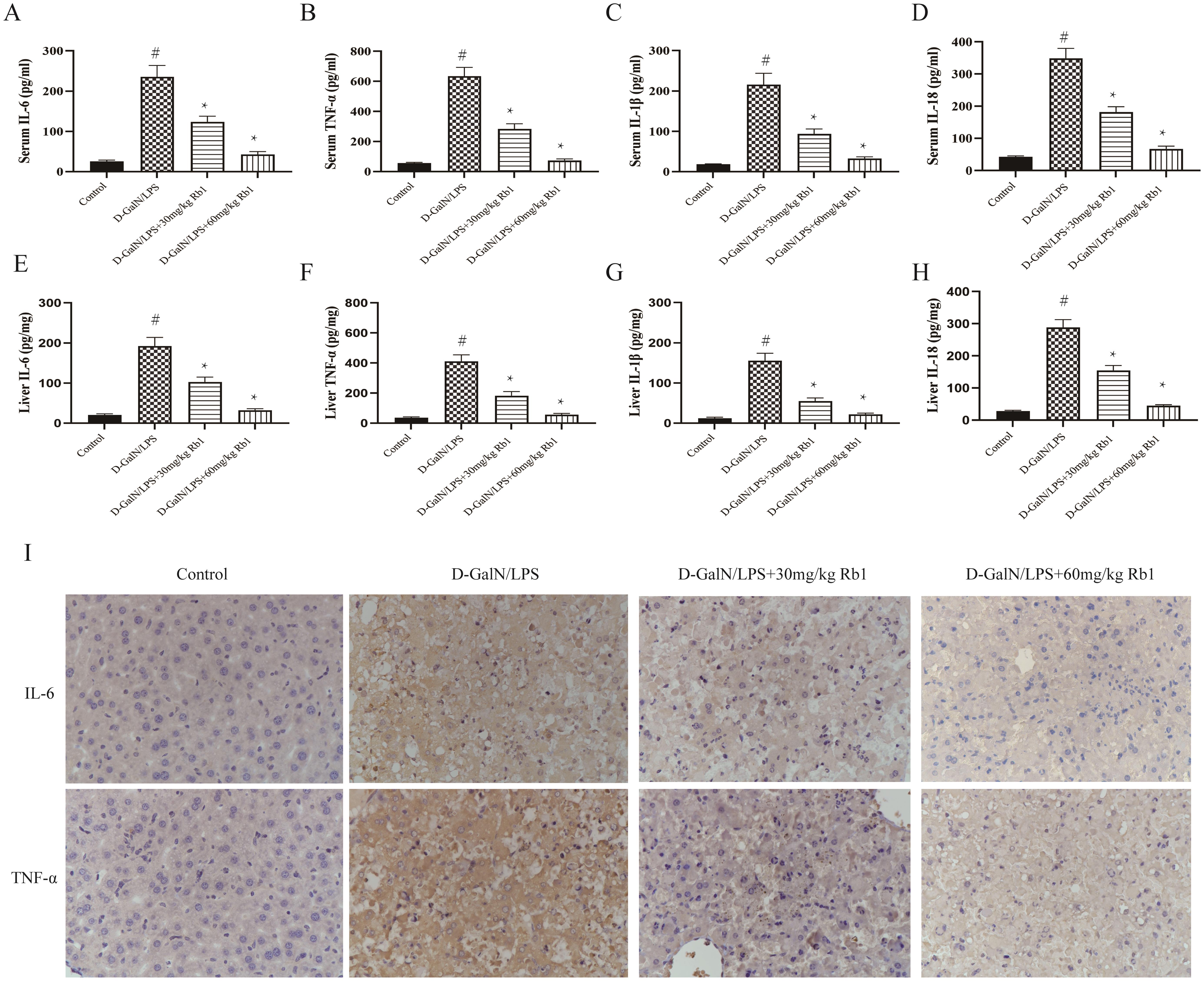 Effect of Rb1 on inflammatory cytokine expression in serum and liver tissue of ALI mice.