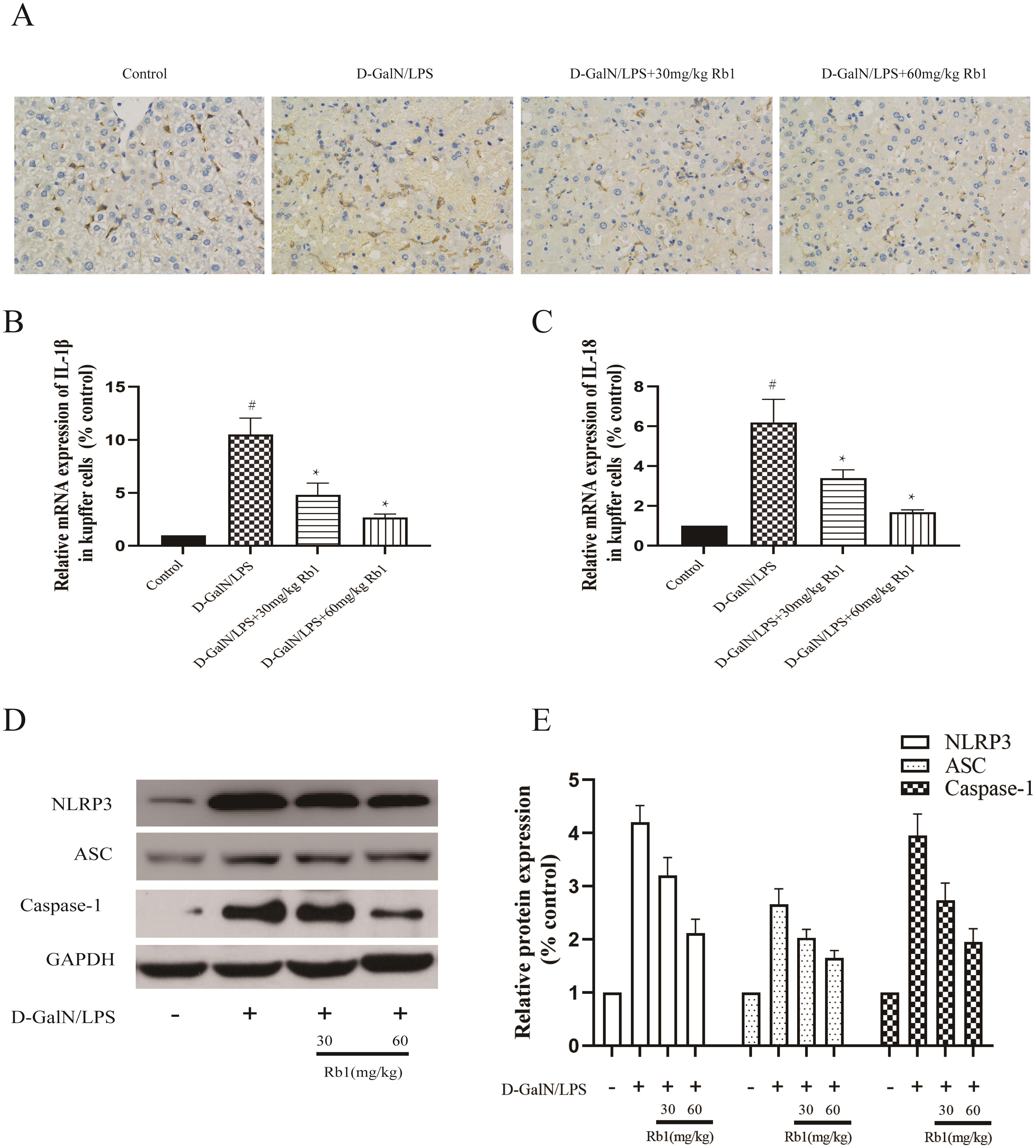 KCs accumulation, and inflammatory cytokine expression and NLRP3 inflammasome activation in KCs among different groups.
