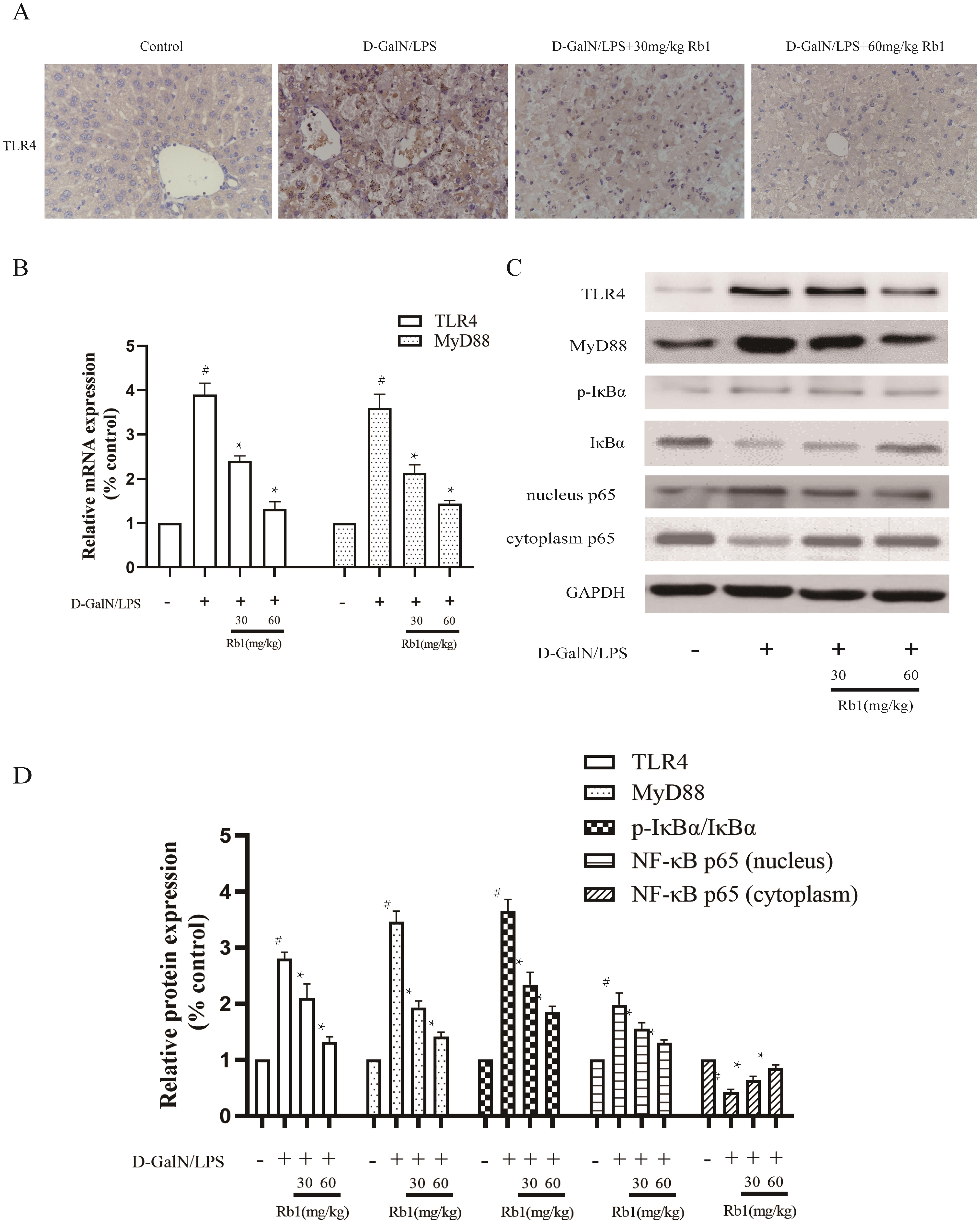 Effect of Rb1 on TLR4/NF-κB signal pathway in D-GalN/LPS-induced ALI mice.