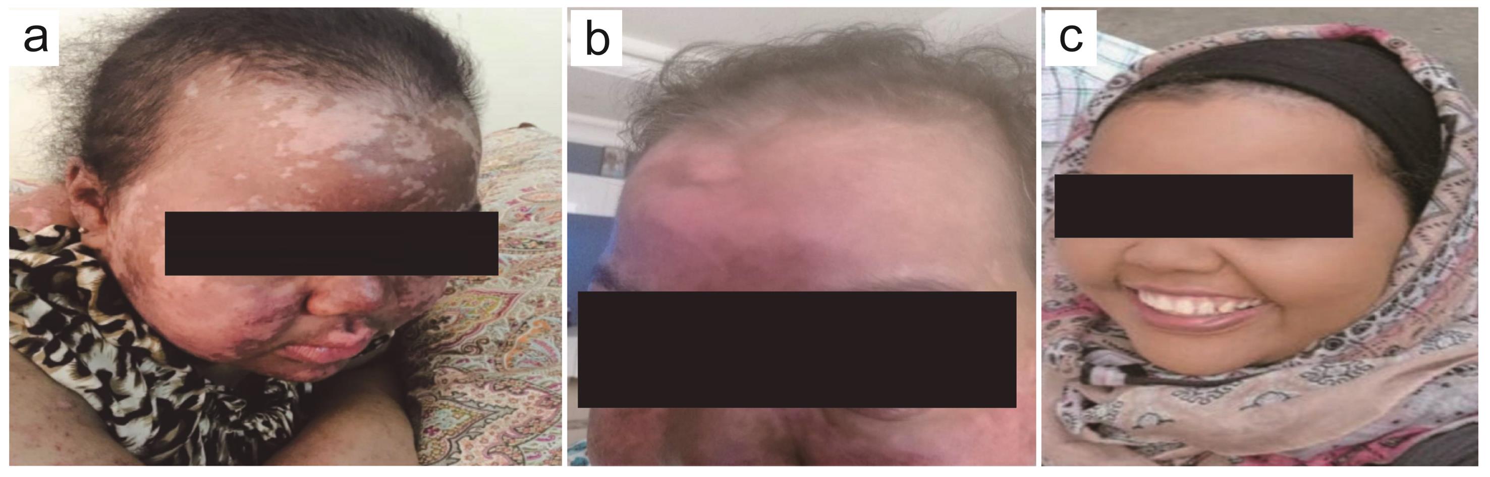 Photos of the patient during the presentation and after discharge.