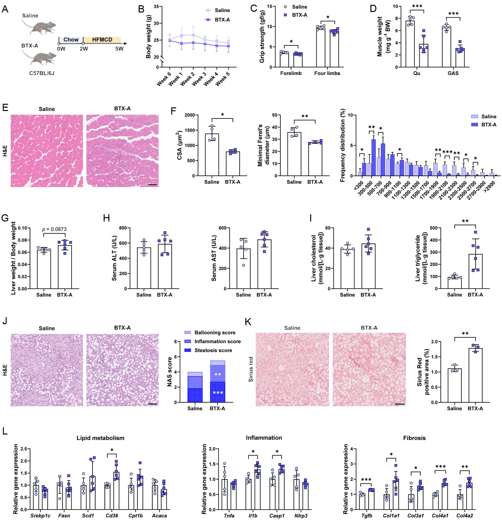 The effects of BTX-A–induced muscle atrophy on MASLD.
