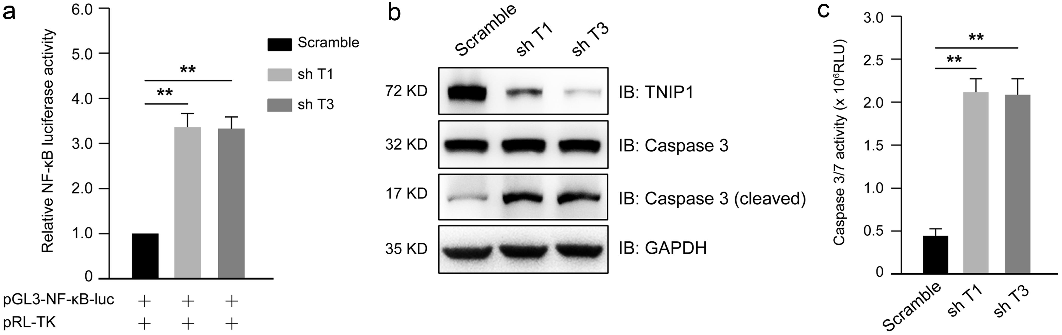 TNIP1 knockdown activated the NF-κB pathway and suppressed breast cancer cell growth.