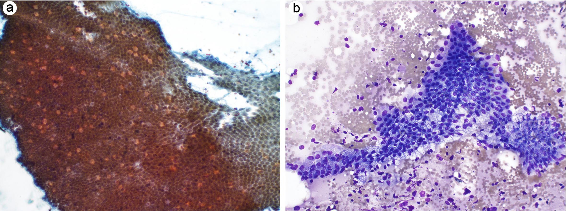 Gastrointestinal contaminant.