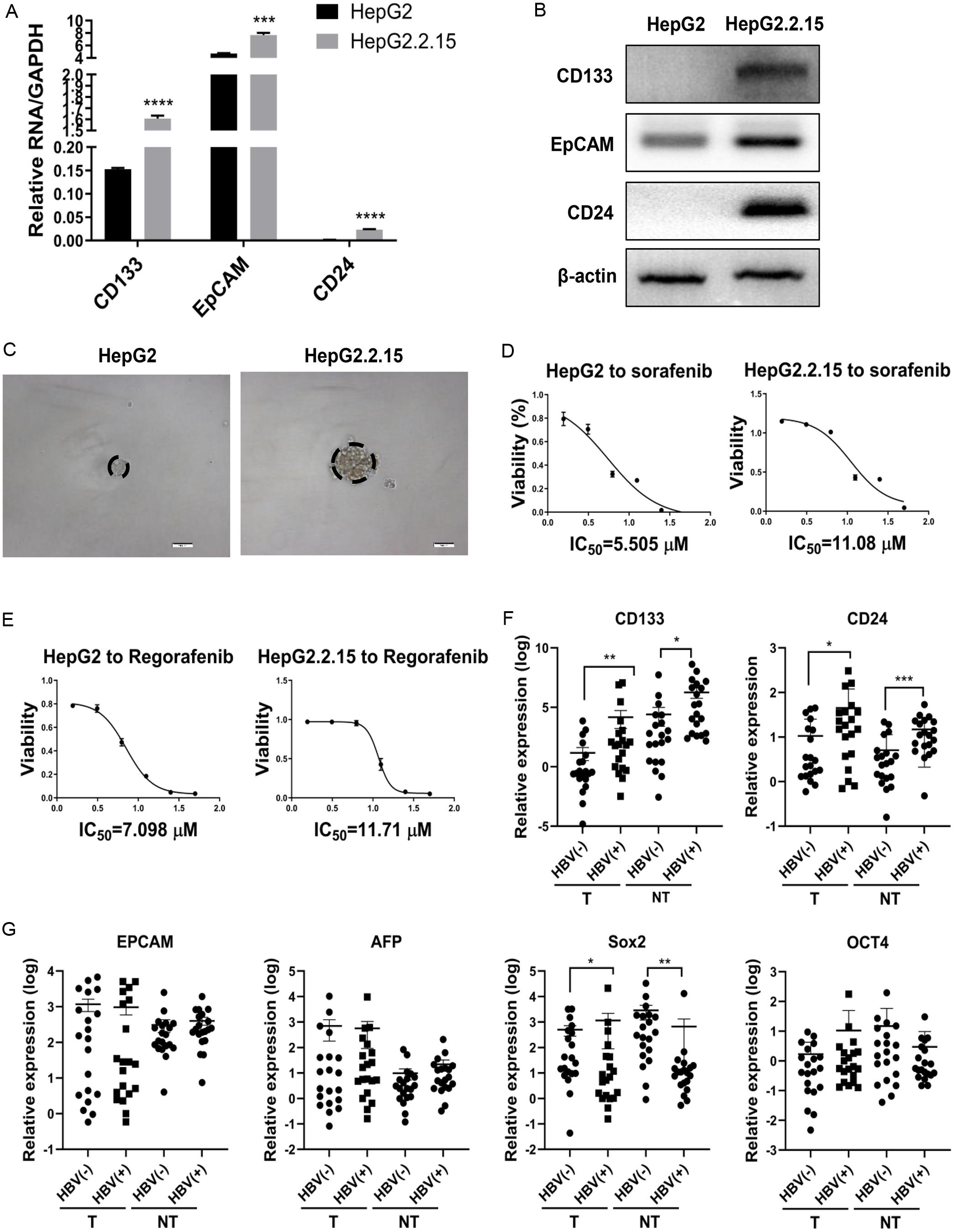 HBV replication affects stemness of HCCs in HepG2.2.15 cells (A-E) and clinical cancer tissues (F-G).