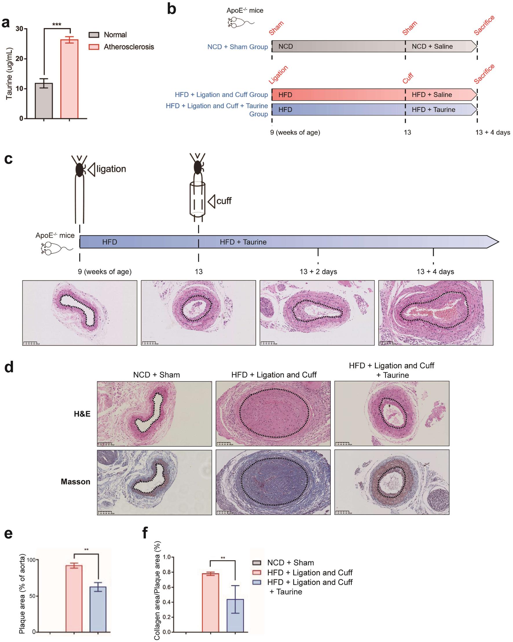 Effects of taurine on plaque formation and stability in atherosclerotic mice.