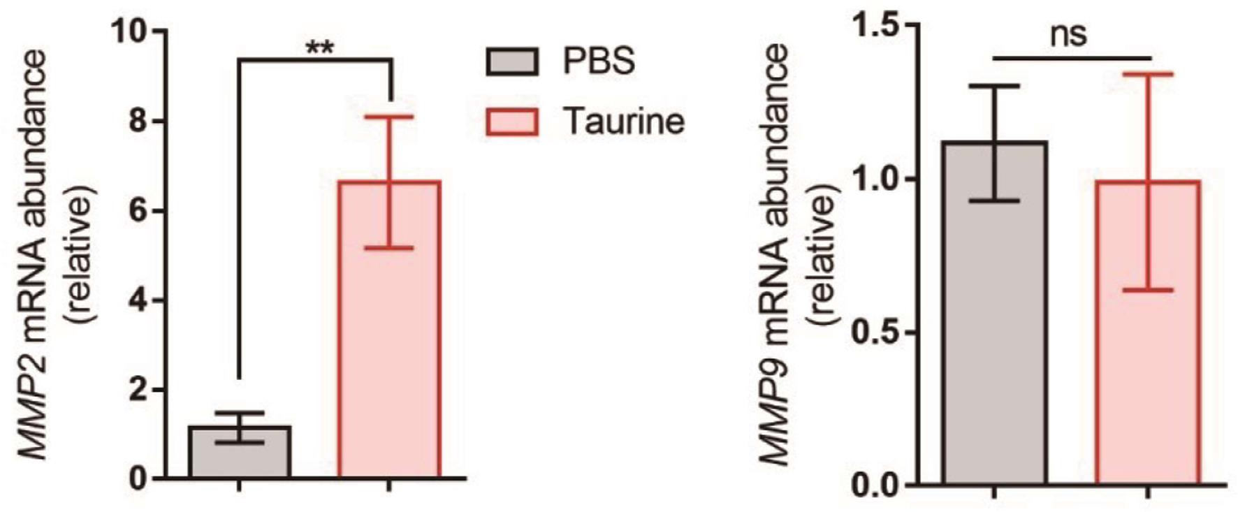 Effects of taurine on the expression of metalloproteinases in vascular endothelial cells (n = 6).