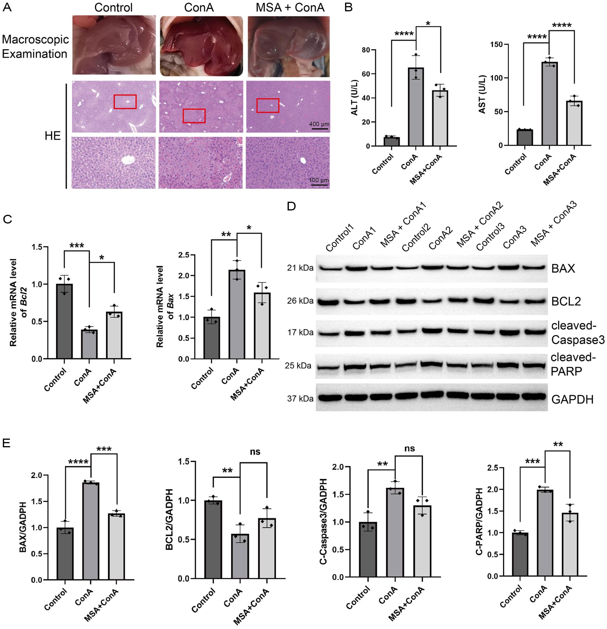 Effects of MSA on liver histology, serum transaminases, and apoptosis-related markers in the ConA-induced AIH mouse model.