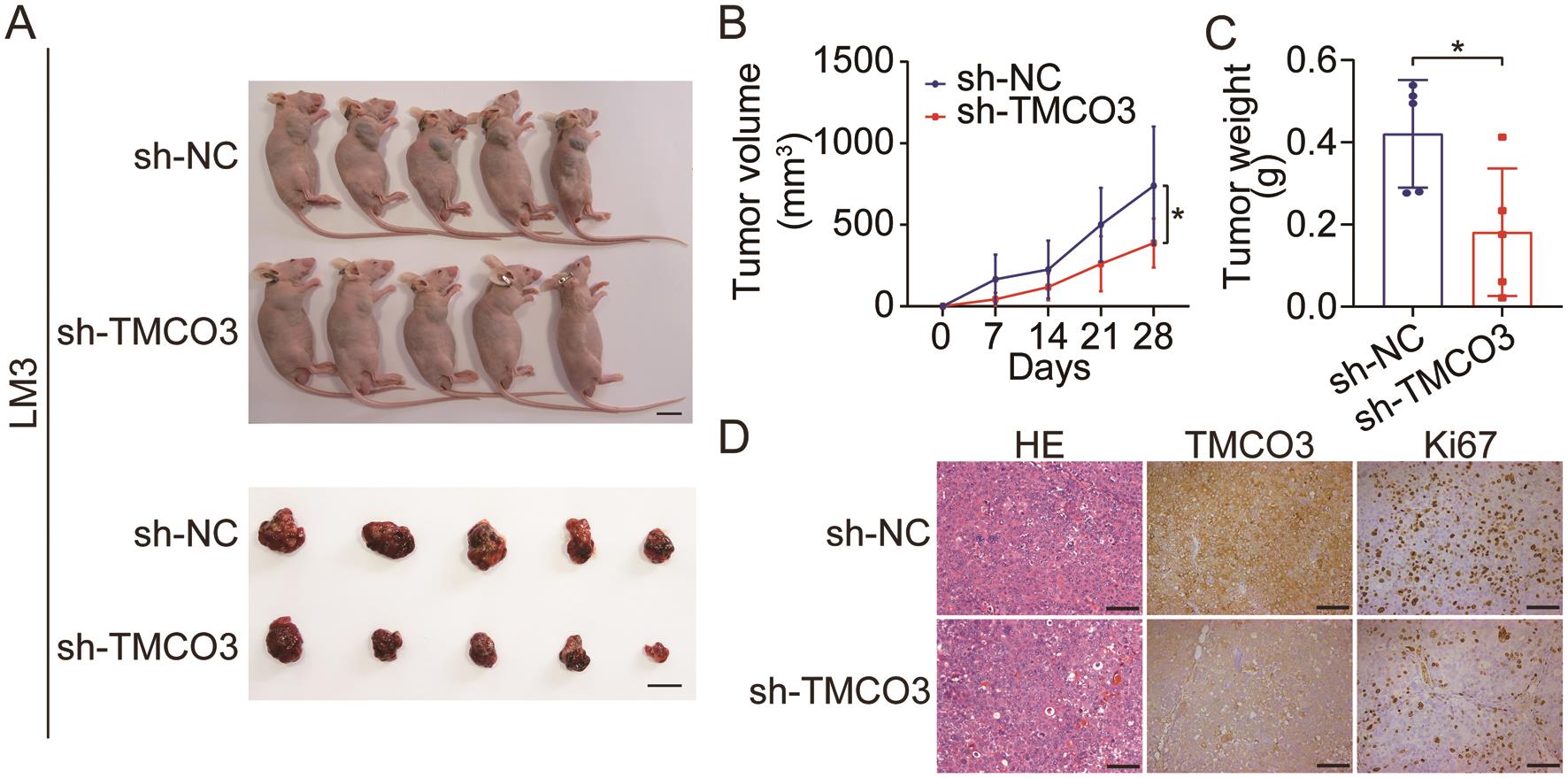 Suppression of TMCO3 inhibits tumorigenicity of HCC <italic>in vivo</italic>.