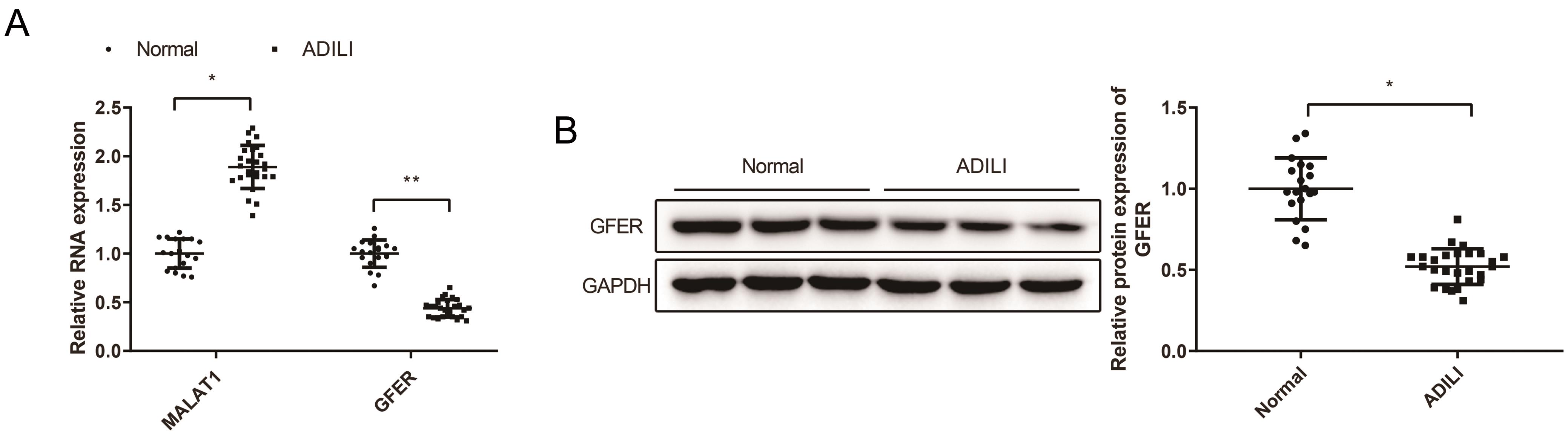 Elevated MALAT1 expression and reduced GFER in ALI.