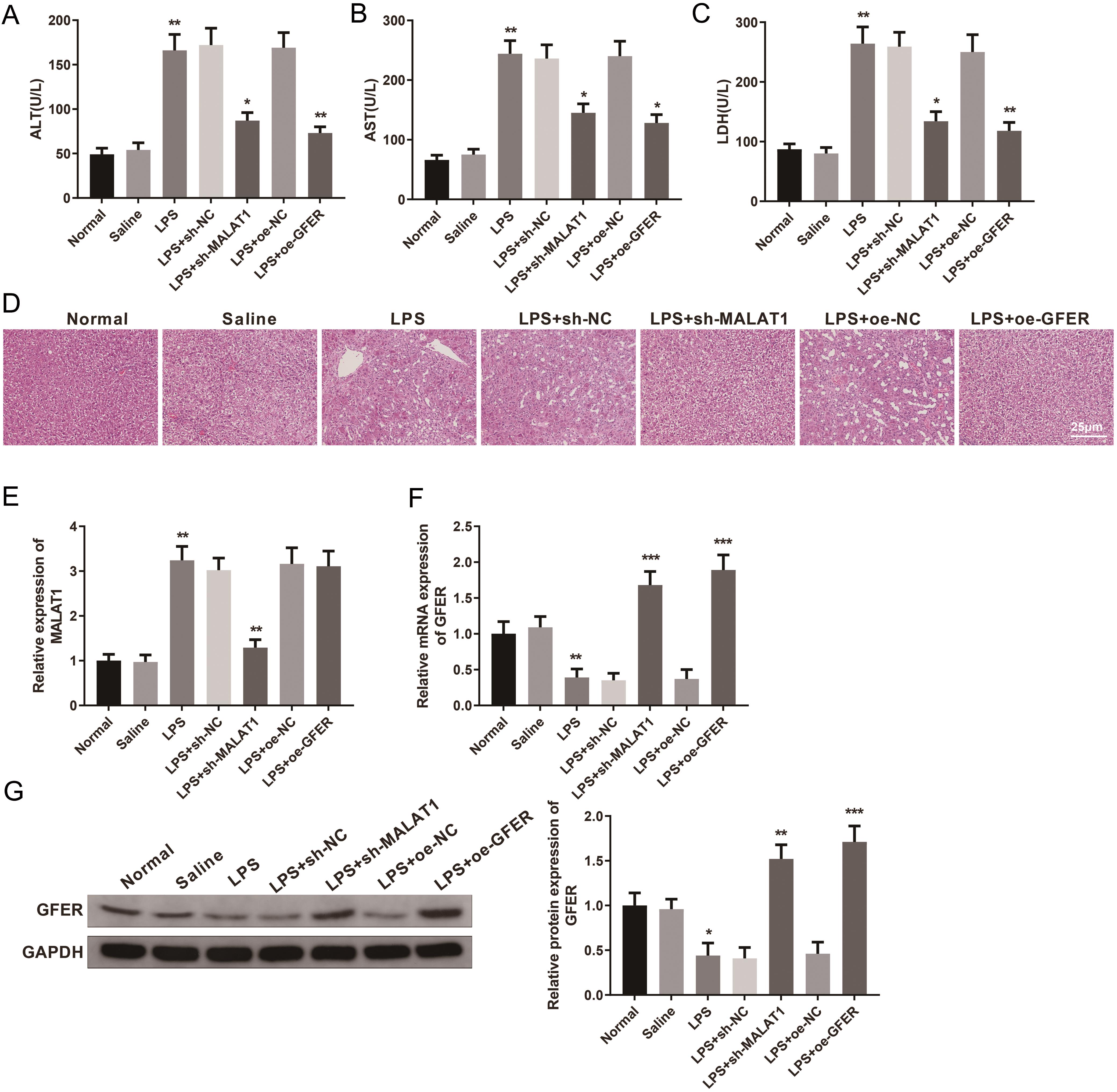 Downregulation of MALAT1 increases GFER expression in ALI-treated rats.