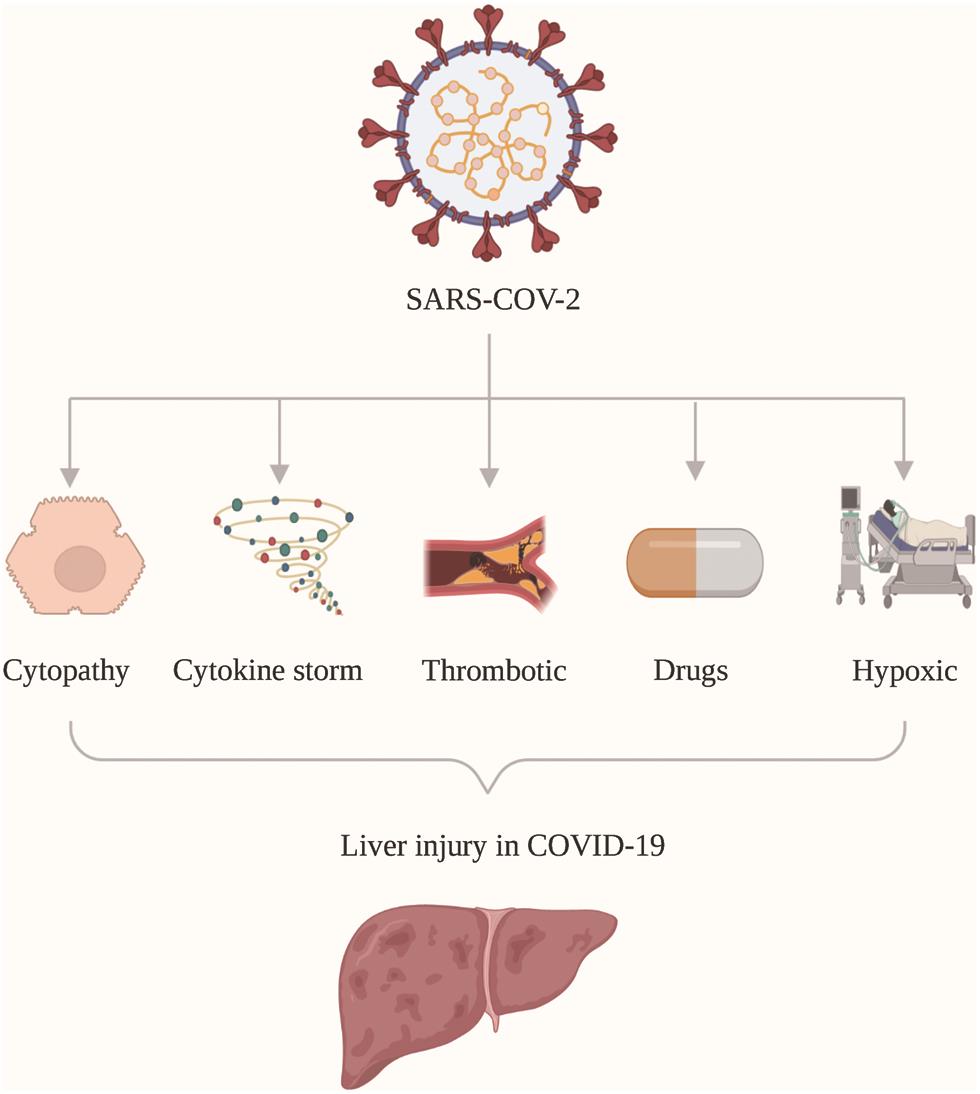 Pathogenesis of liver injury in COVID-19.