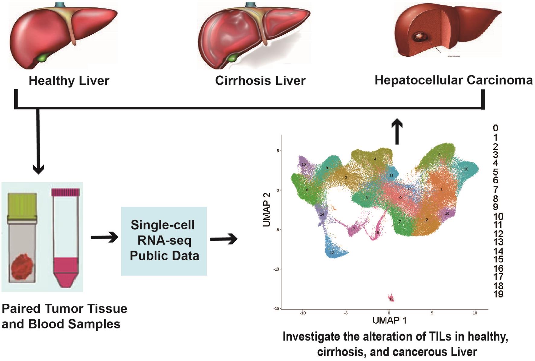 Single Cell Rna Seq Revealed That Altered Tumor Infiltrating Lymphocytes In Cirrhotic Liver 9142