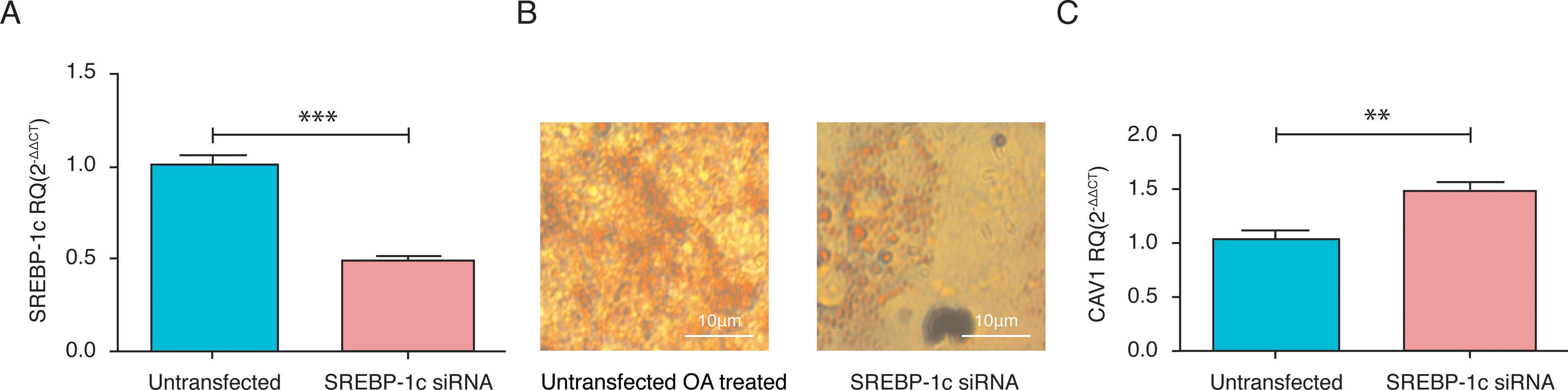 Impact of SREBP-1c siRNA on lipid droplet (LD) formation and CAV1 expression.