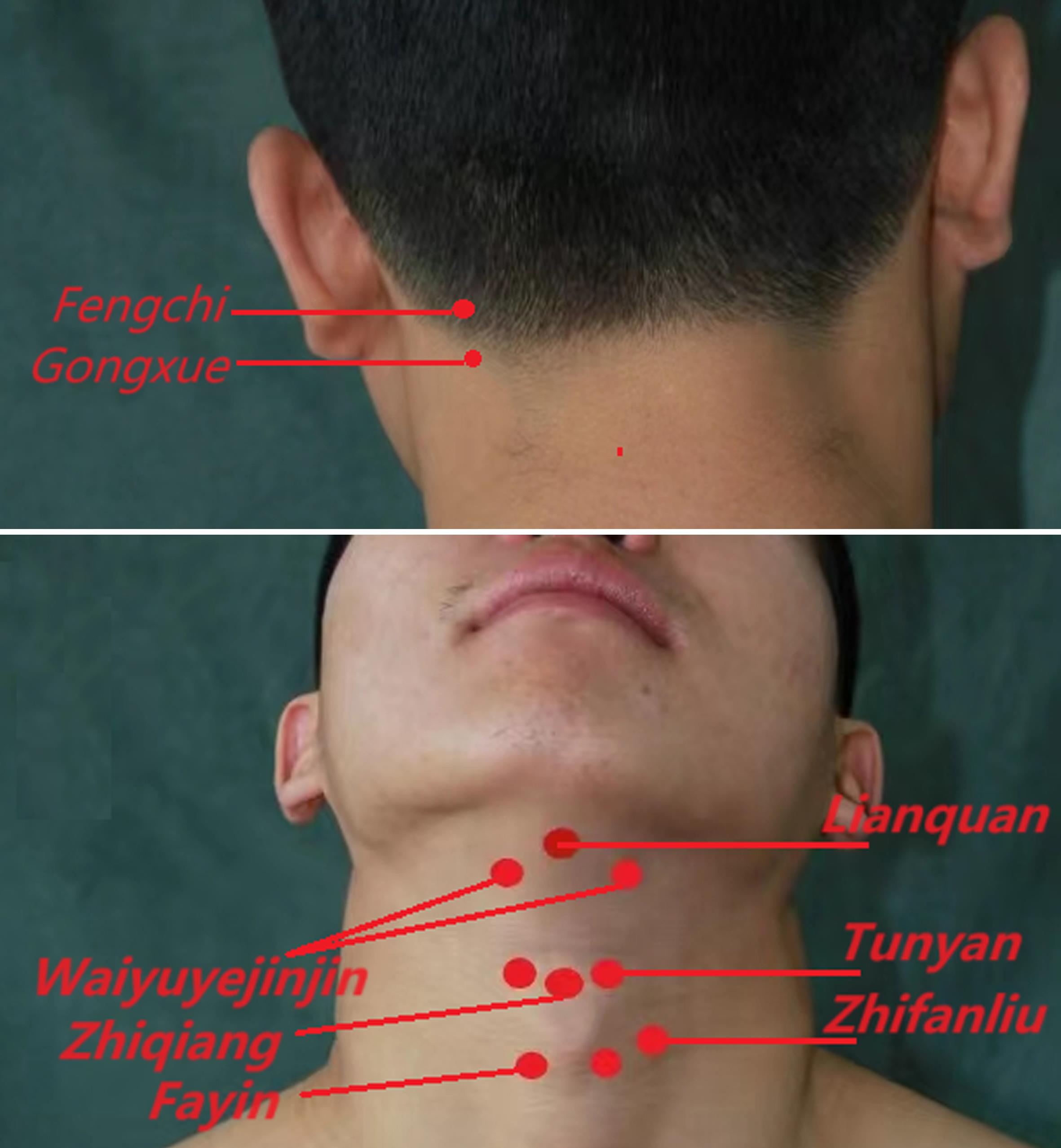 Acupuncture point diagram.