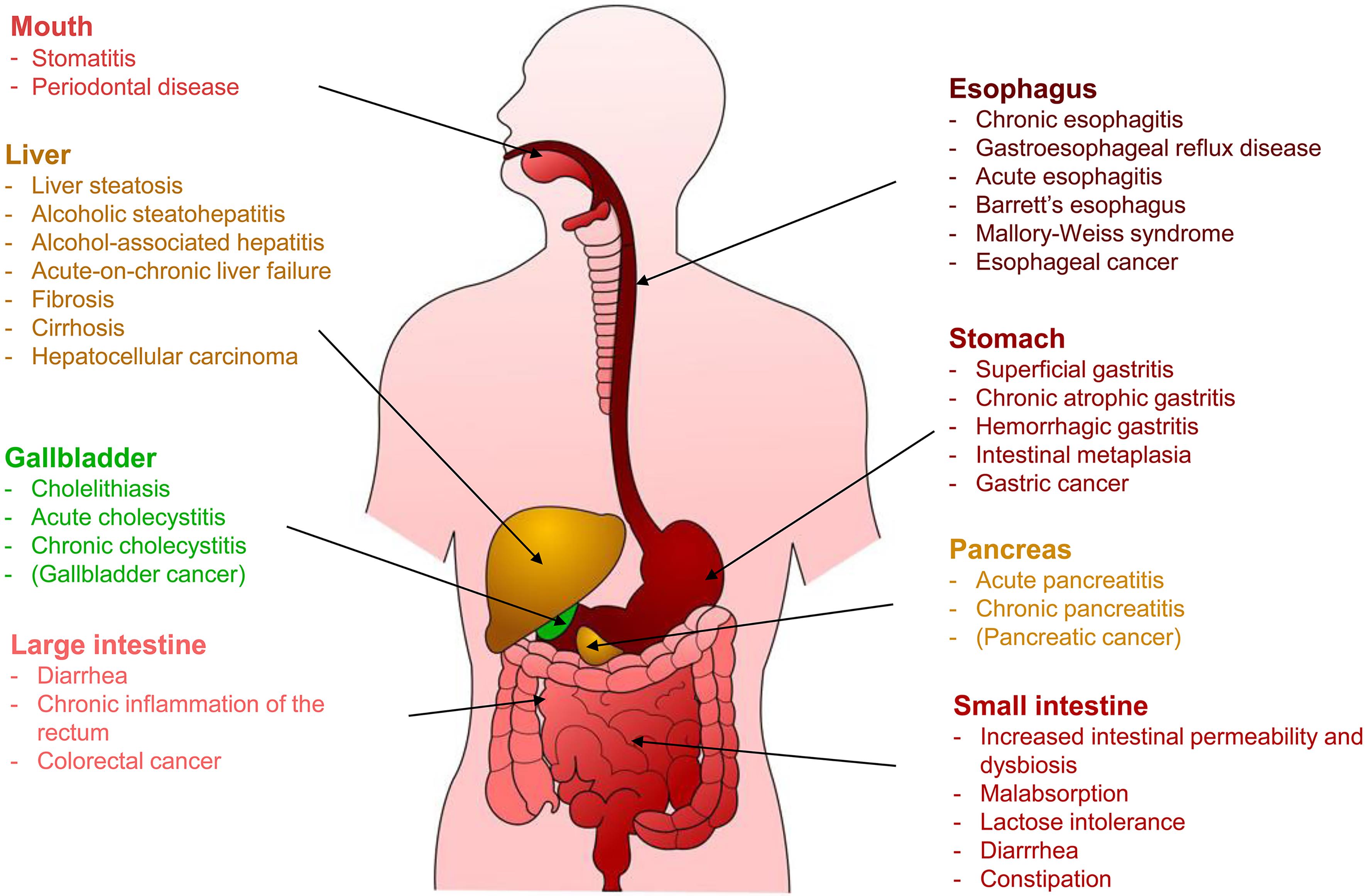 Acute and chronic pathological effects of ethanol on the digestive system.