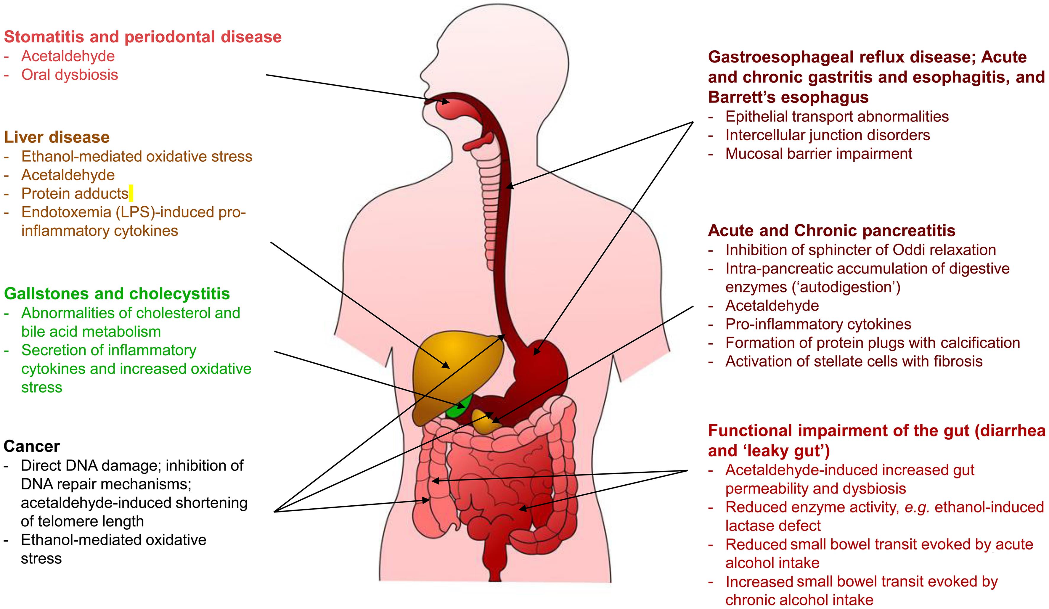 Main molecular mechanisms and related clinical conditions of alcohol-induced digestive system damage.