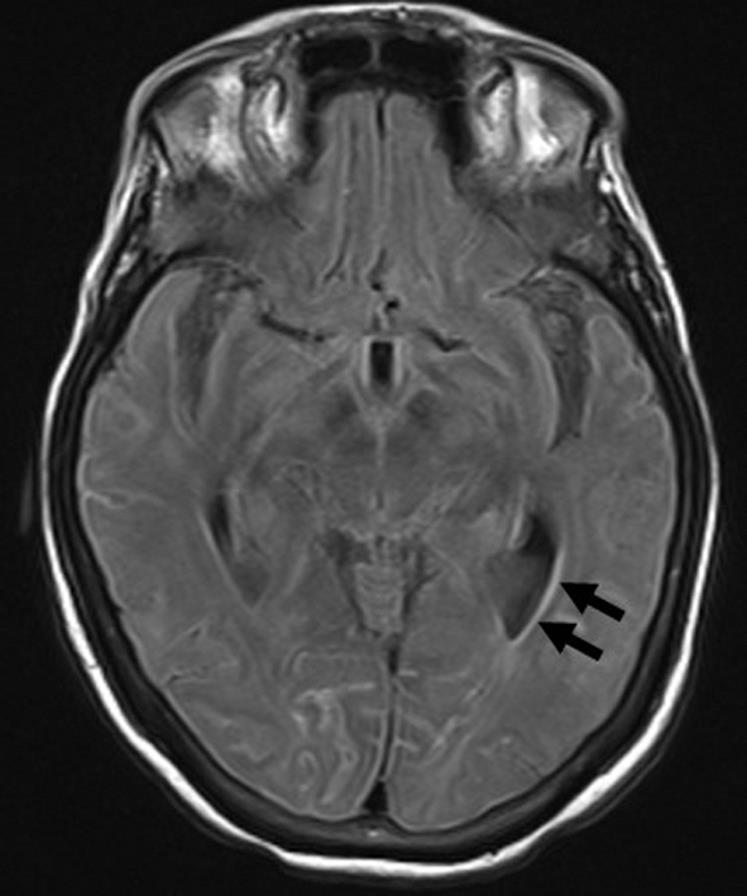 MRI with and without contrast for Case 1.