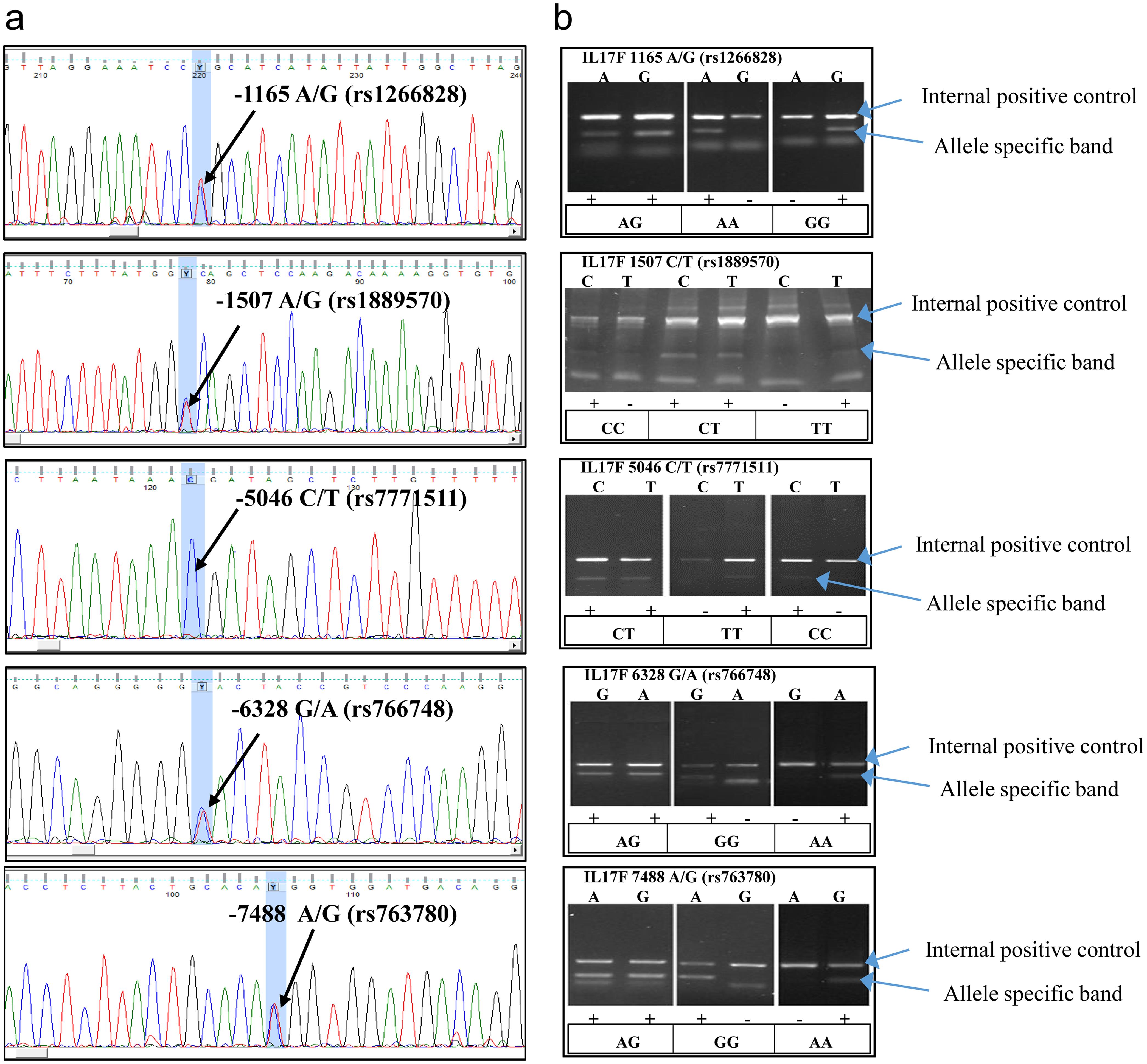 Representative electropherogram of validation of PCR–SSP-based genotyping through direct sequencing.