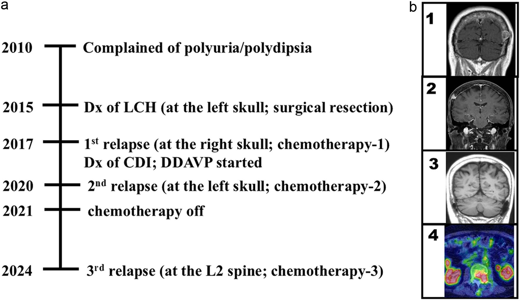 Clinical course of the patient (a) and images of LCH lesions (b).