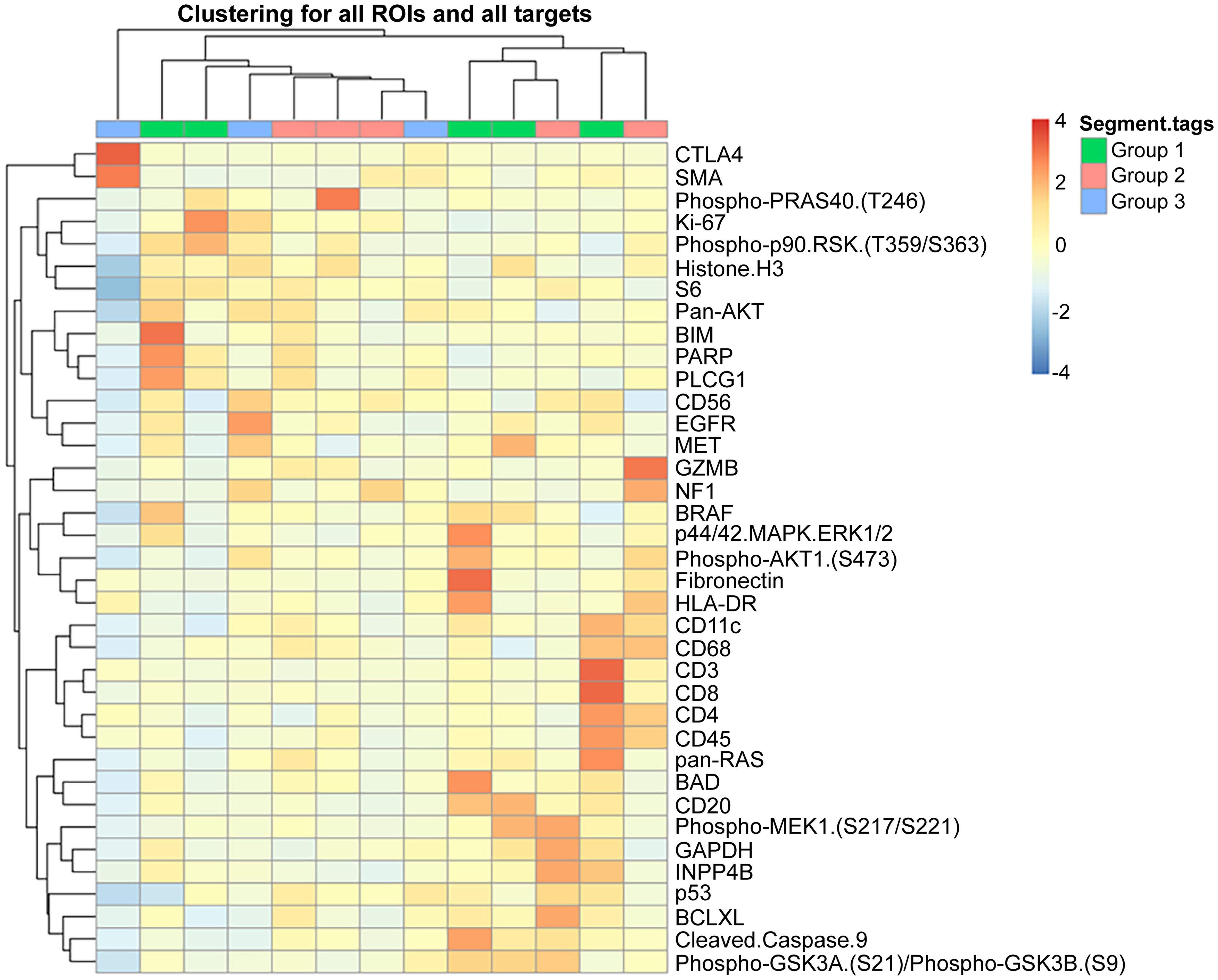 Heat map-based digital spatial profiling analysis of expressed protein targets in three different clinical groups of rhabdomyosarcoma.