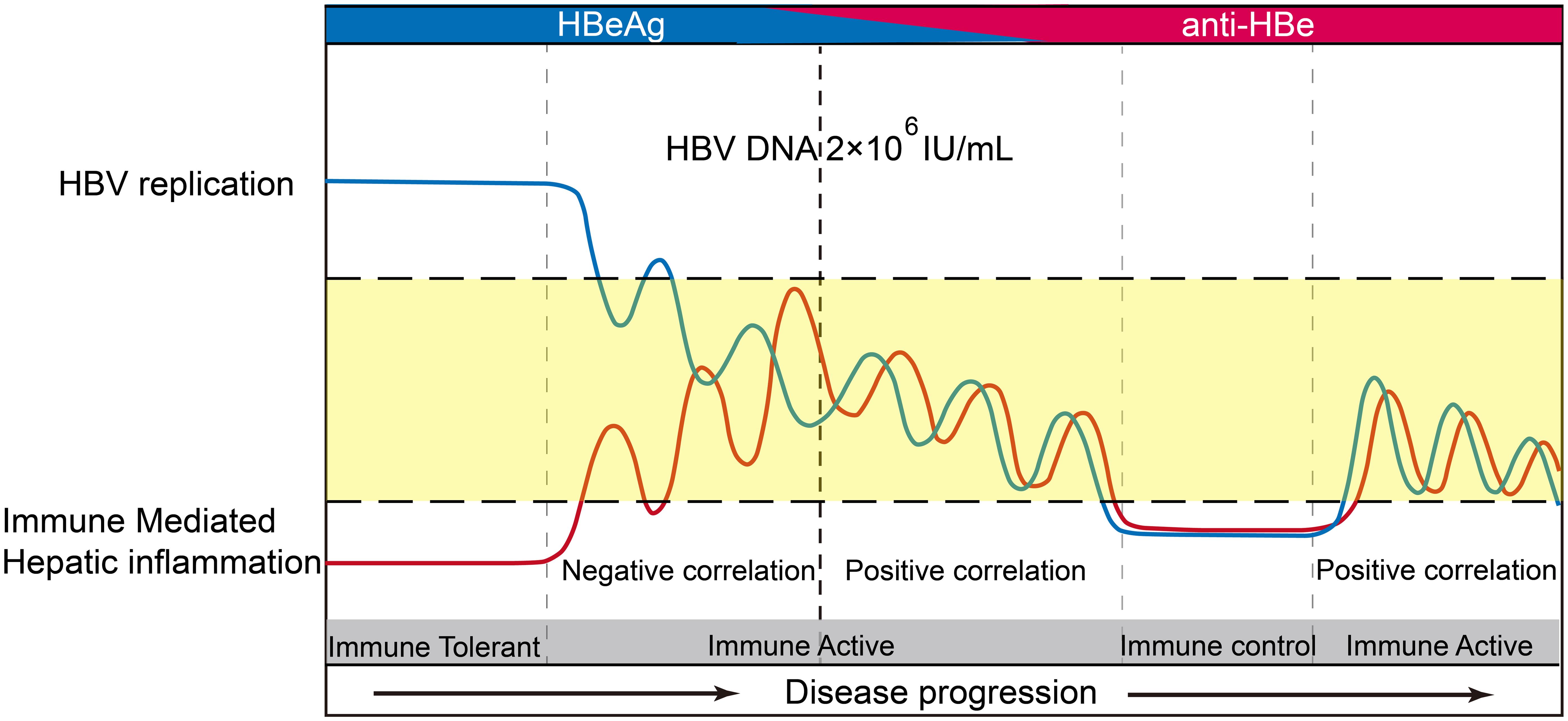 Schematic diagram of the relationship between viral replication and the severity of hepatic necroinflammation of CHB in disease progression.