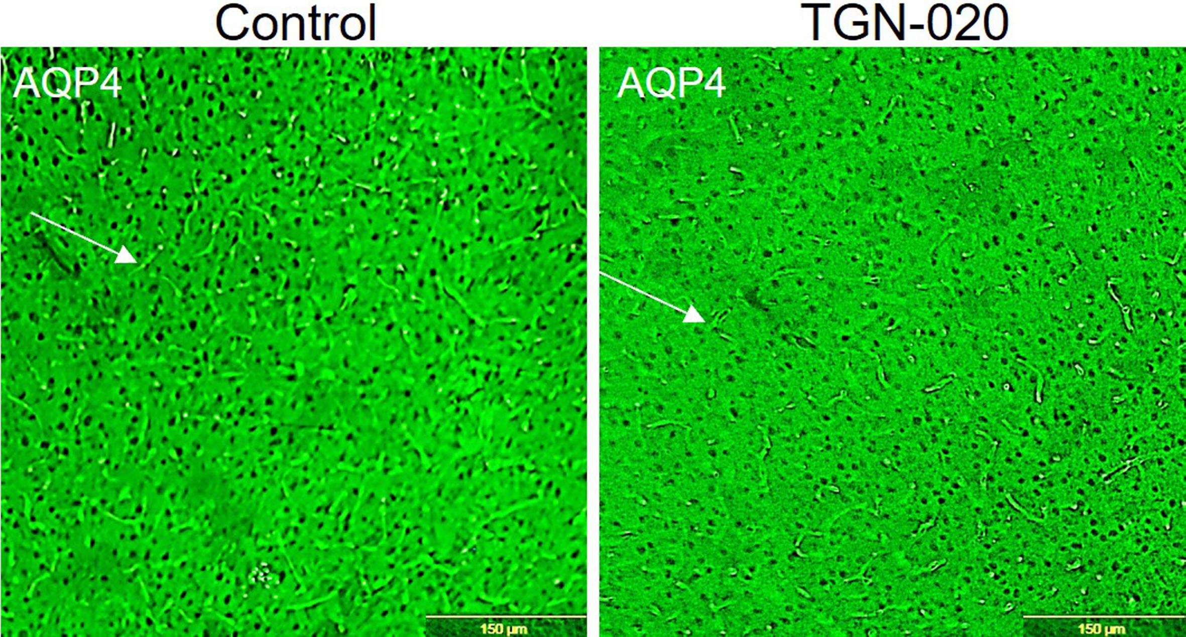 Effect of TGN-020 on the expression of AQP4.