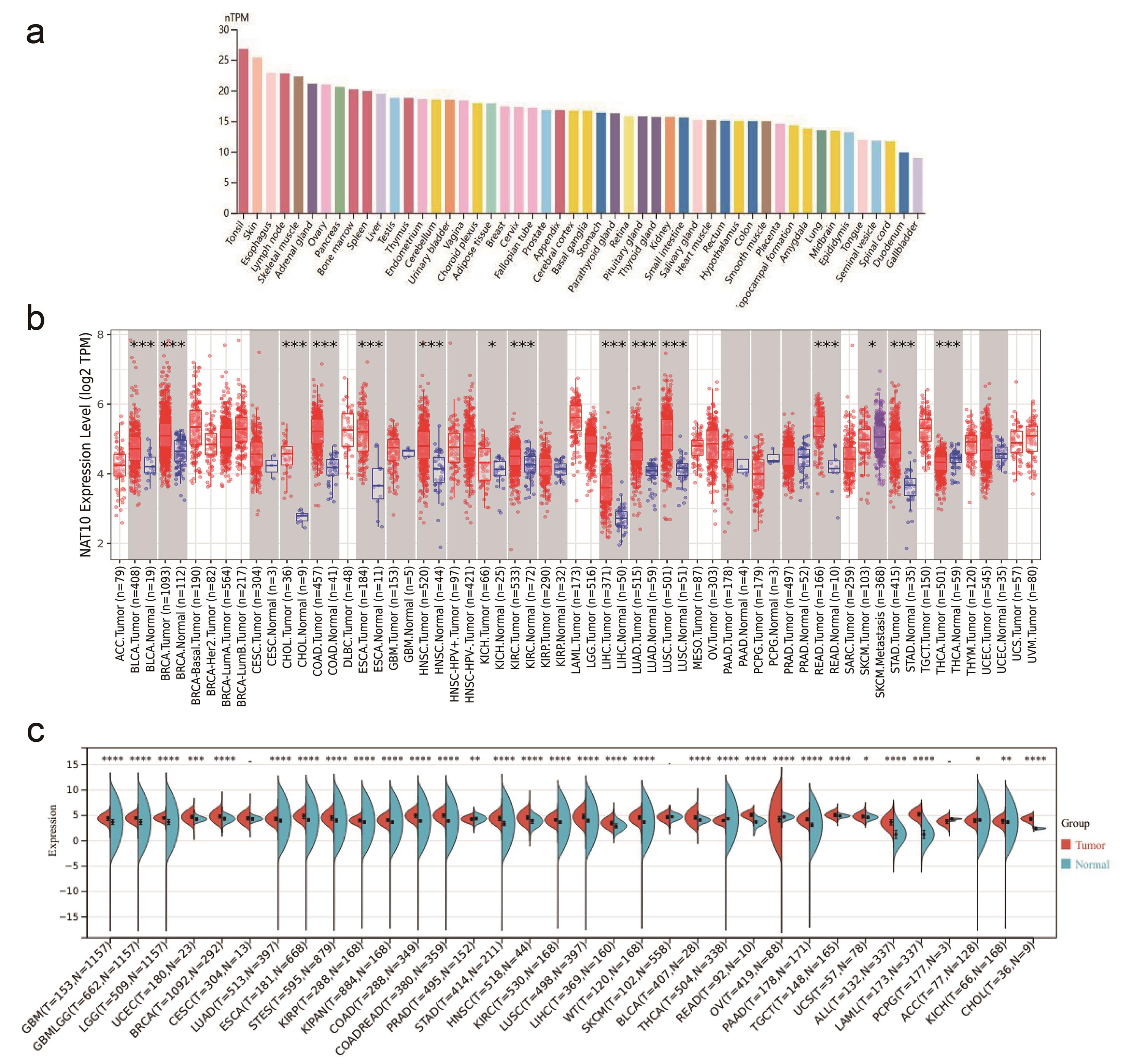 Pan-cancer expression profile of NAT10.