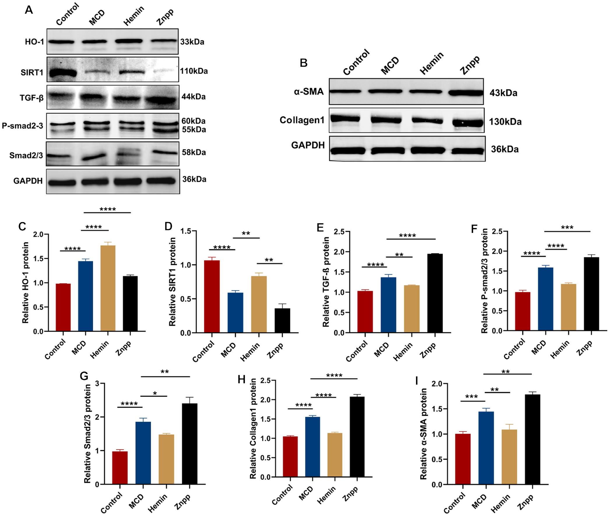 HO-1 overexpression upregulates SIRT1 expression and exacerbates liver fibrosis in MCD mice.