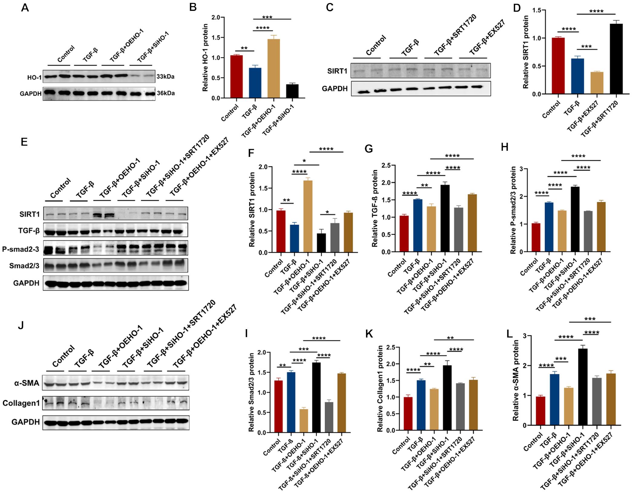 HO-1 mediates NAFLD-related liver fibrosis <italic>in vitro</italic> by regulating the SIRT1/TGF-β/Smad3 signaling pathway.
