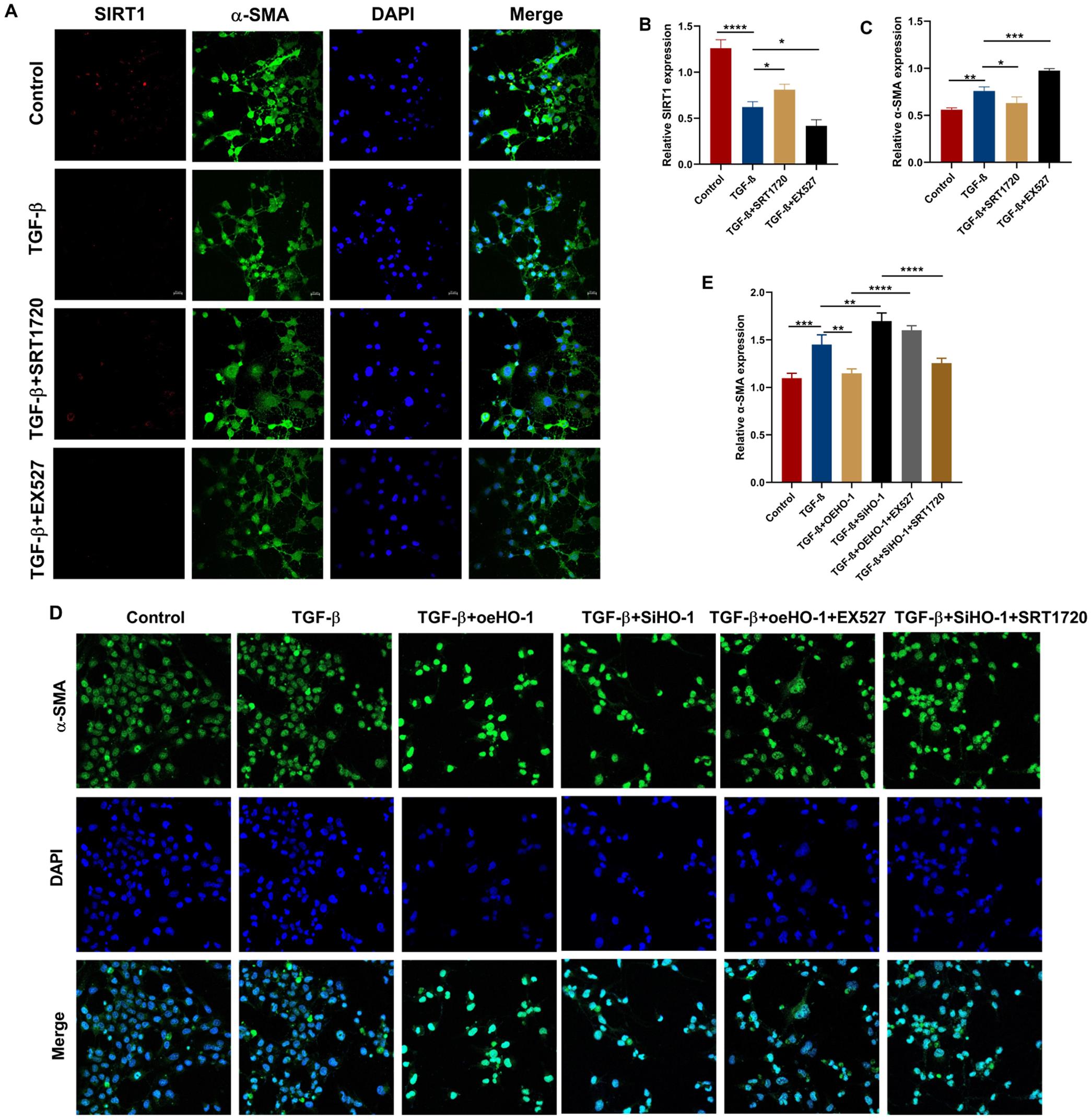 SIRT1 inhibits the activation of hepatic stellate cells.