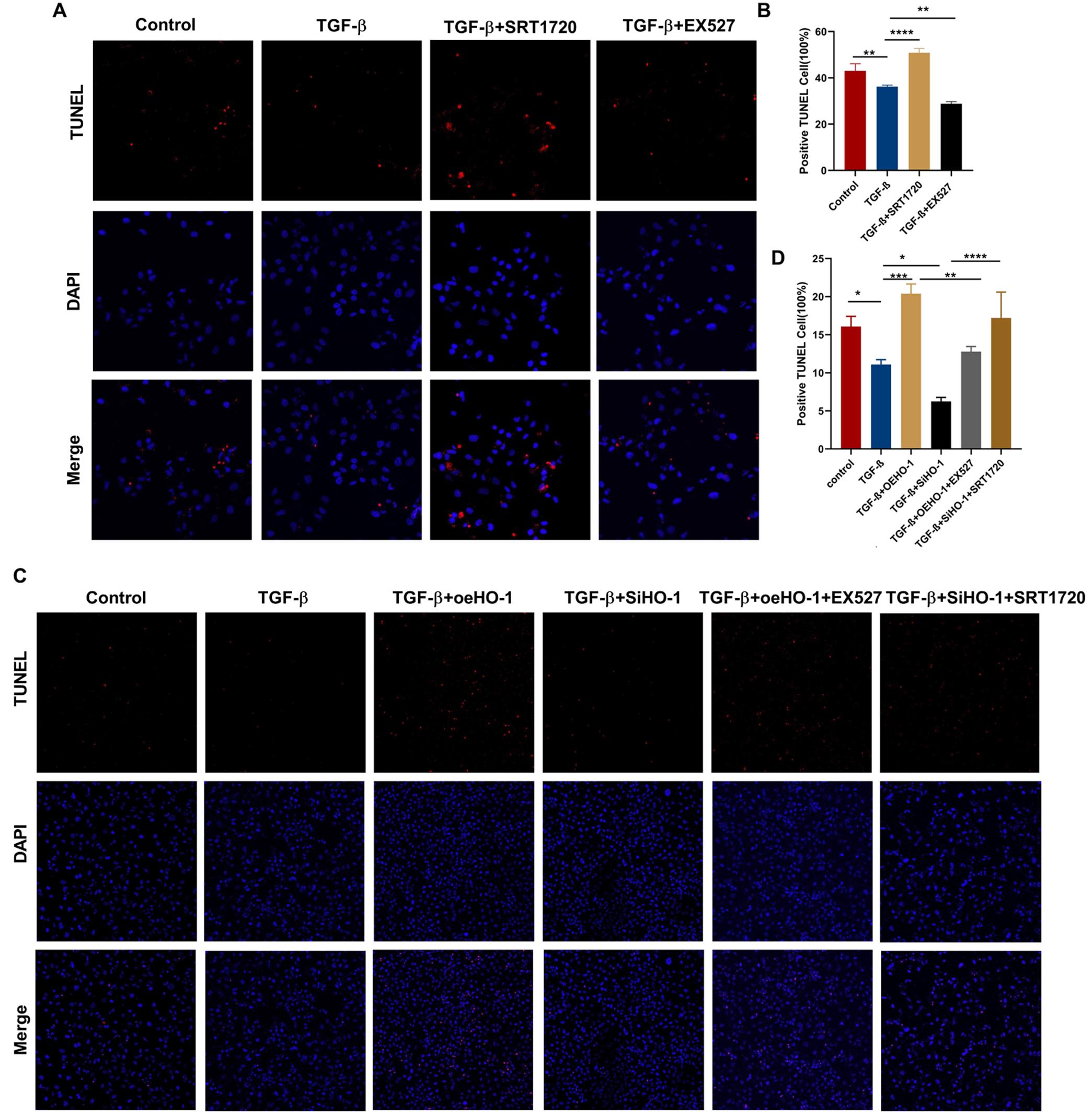 SIRT1 promotes apoptosis in LX2 cells.