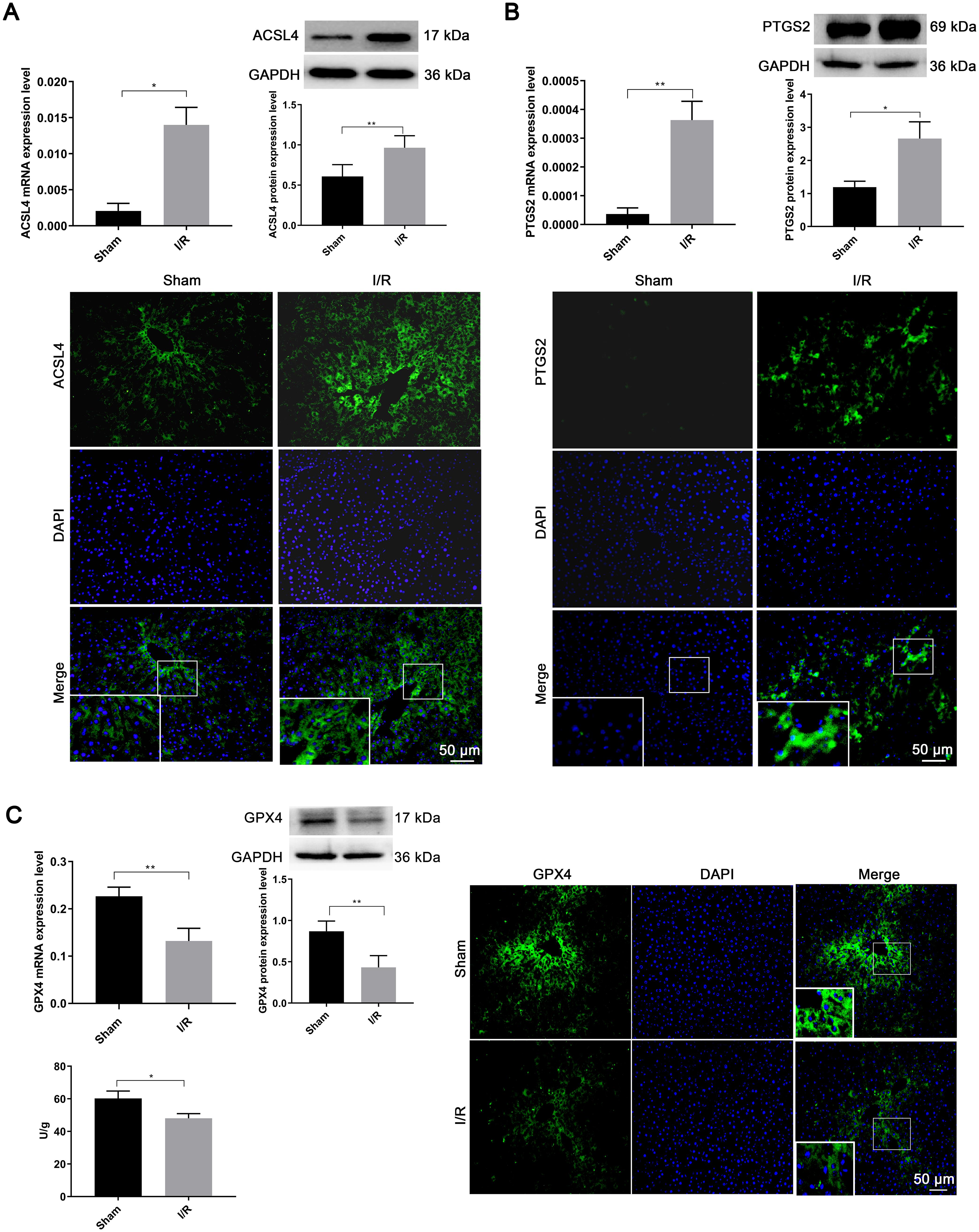 Changes in ferroptosis-related proteins after hepatic ischemia-reperfusion injury.