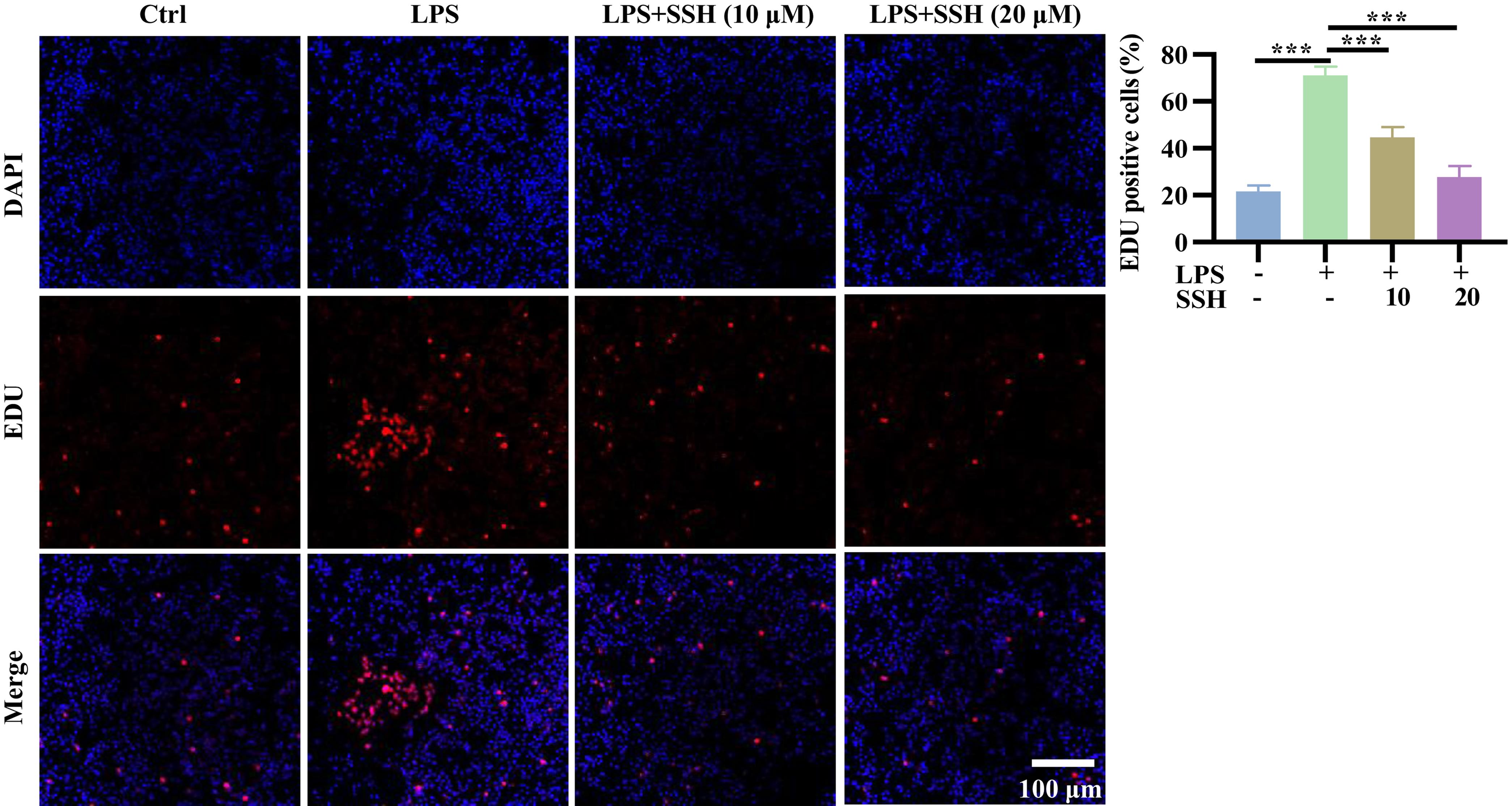 SSH significantly reduced LPS-induced proliferation in macrophages.