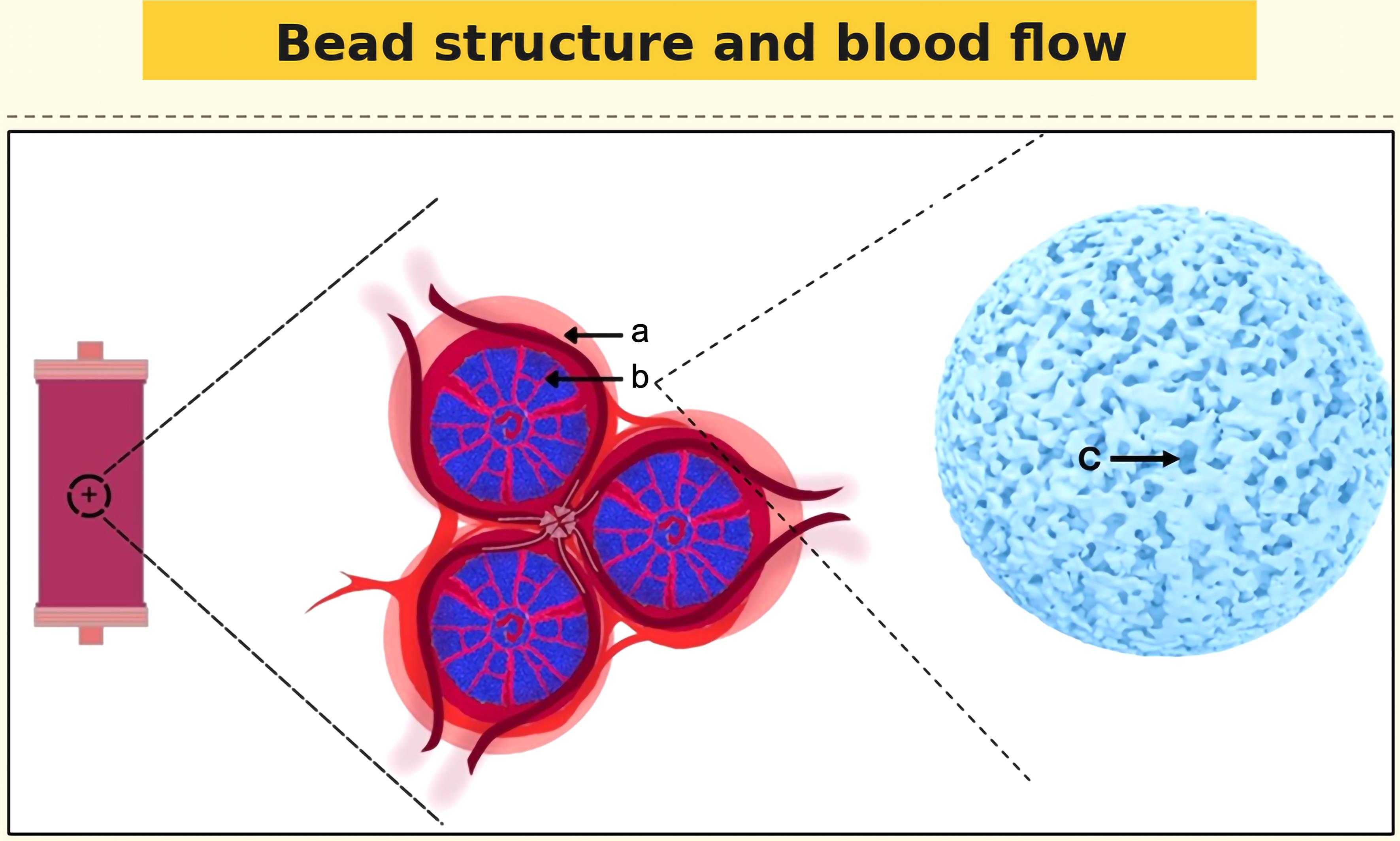 An enlarged view of the bead structure and blood flow within a modern resin polymer cartridge.