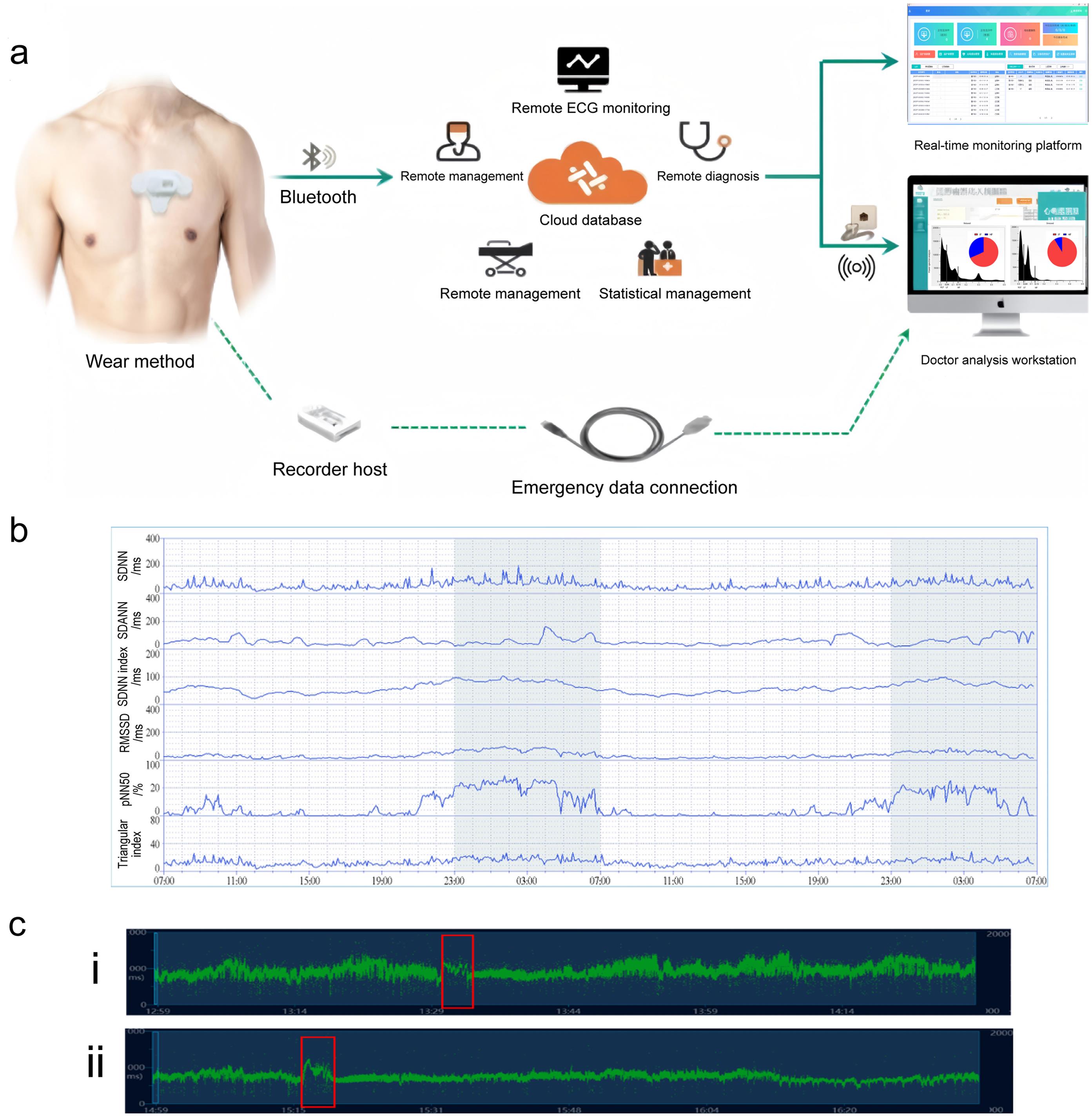 Perioperative long-term HRV monitoring.