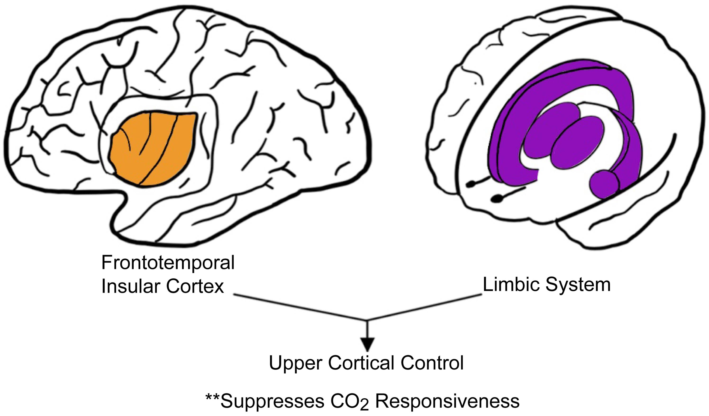 Brain Hypoxia Is Associated With Neuroglial Injury in Humans Post–Cardiac  Arrest