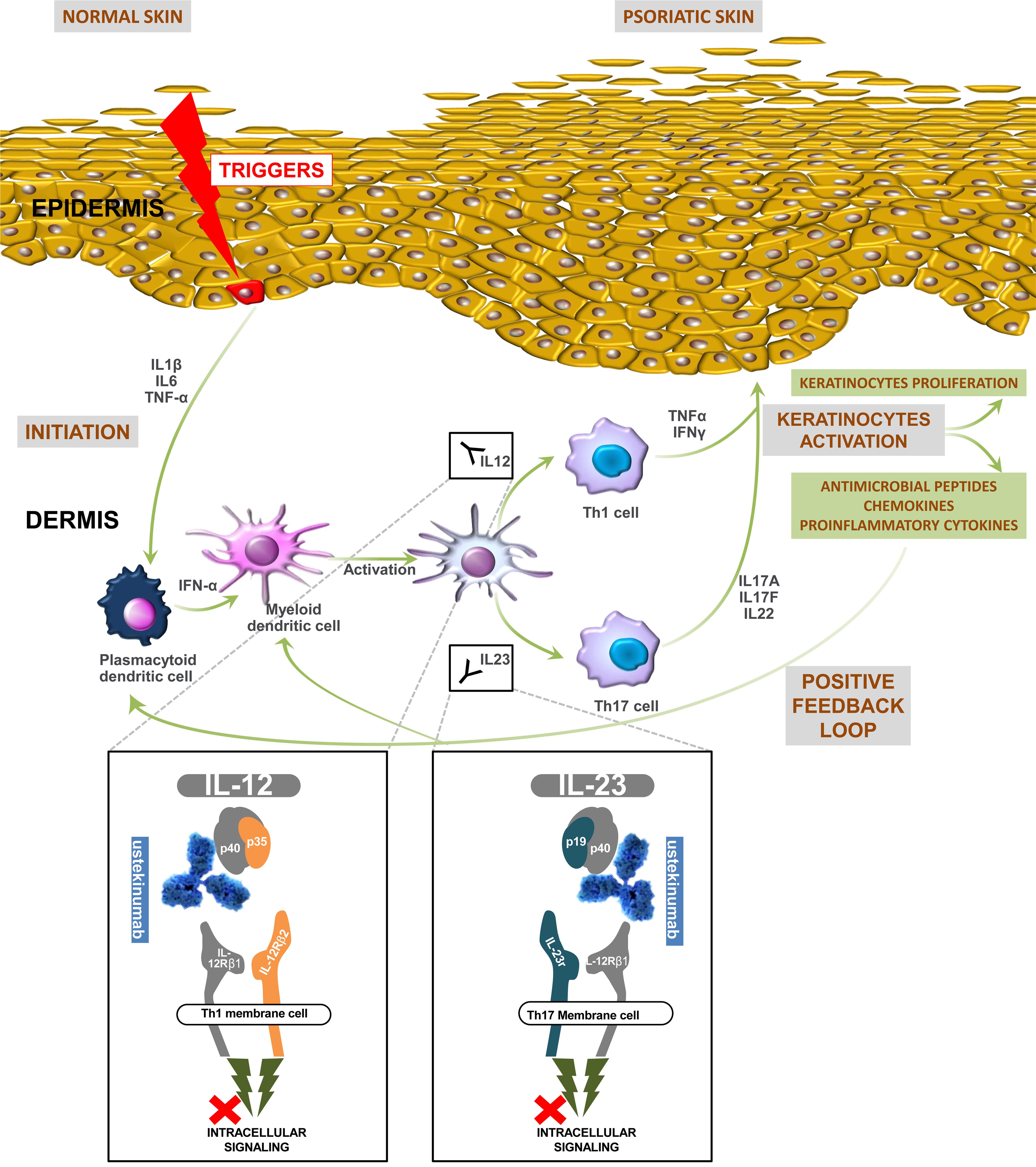 Current concepts in psoriasis pathophysiology and ustekinumab mechanism of action.