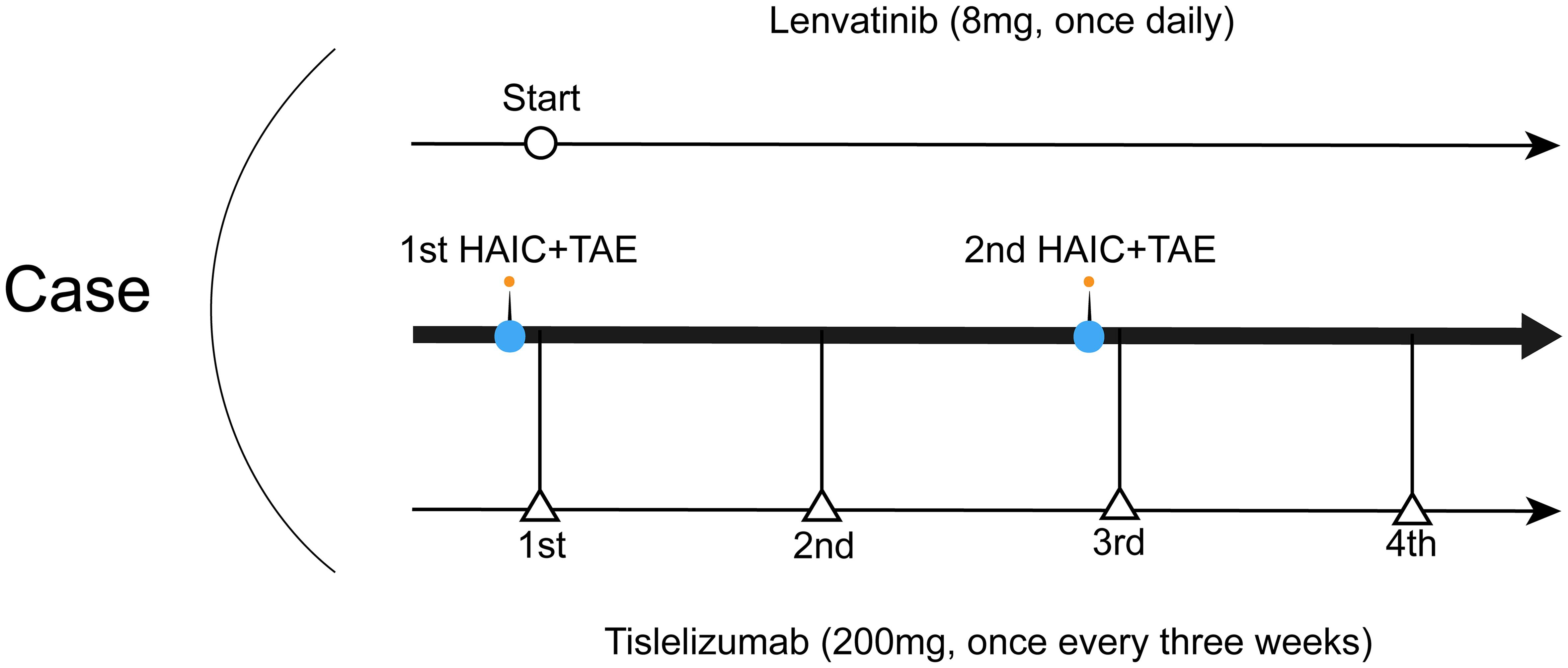 Schematic diagram showing the treatment process.