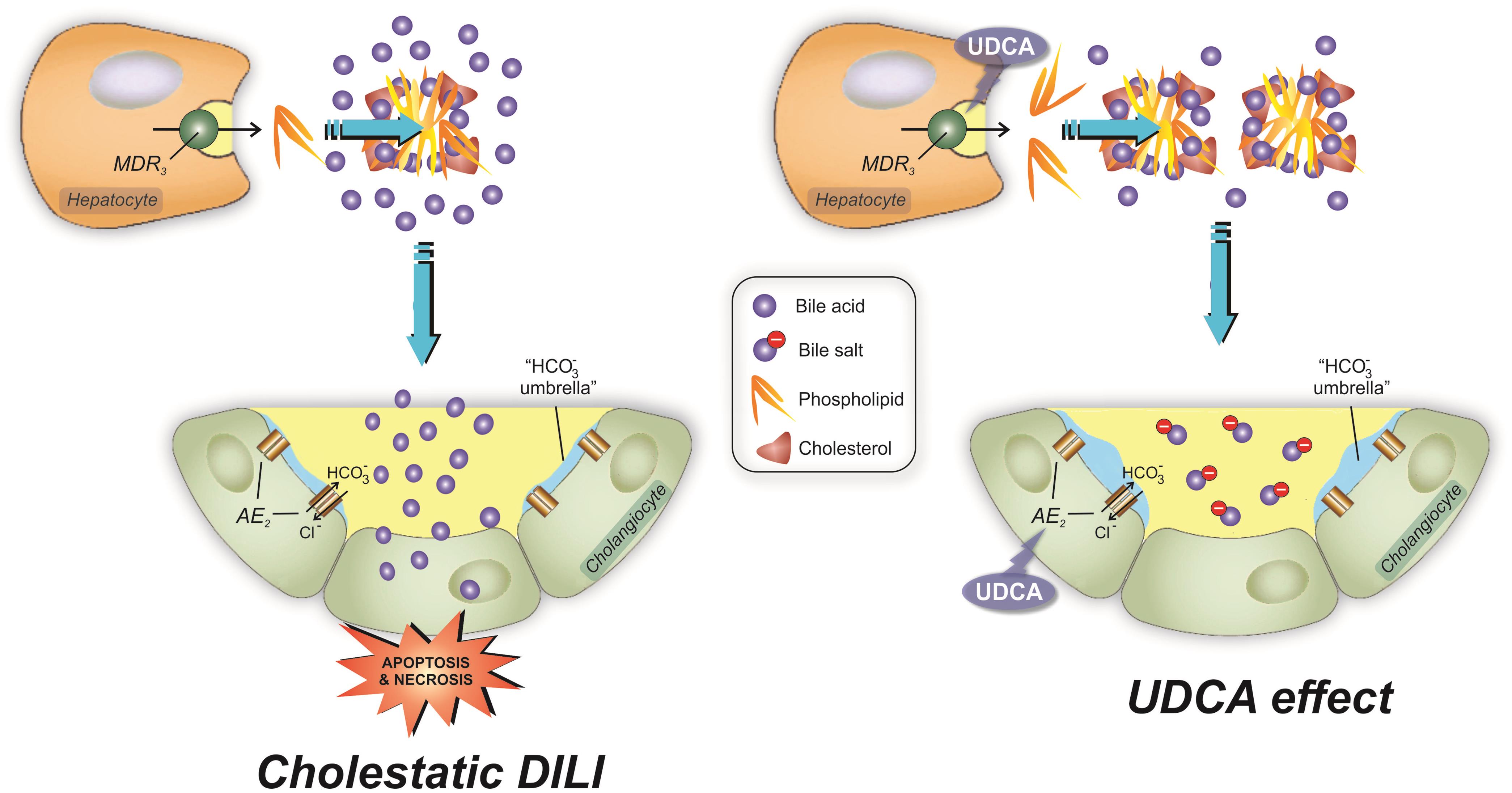 The mechanisms of protection of biliary cells against bile acid-induced damage are often impaired in “cholestatic” DILI.