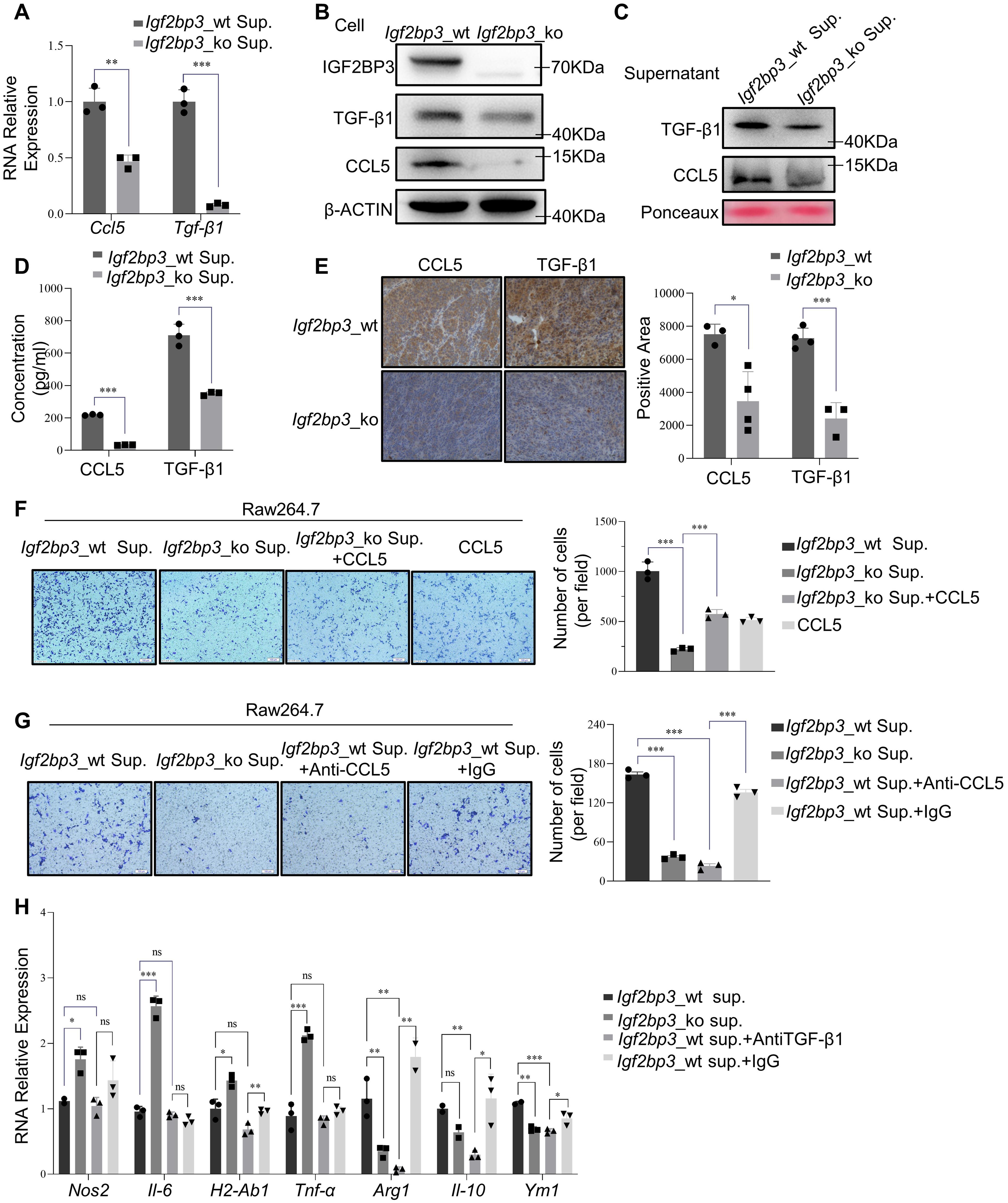 IGF2BP3 facilitates macrophage infiltration and polarization by promoting the secretion of CCL5 and TGF-β1 from tumor cells.