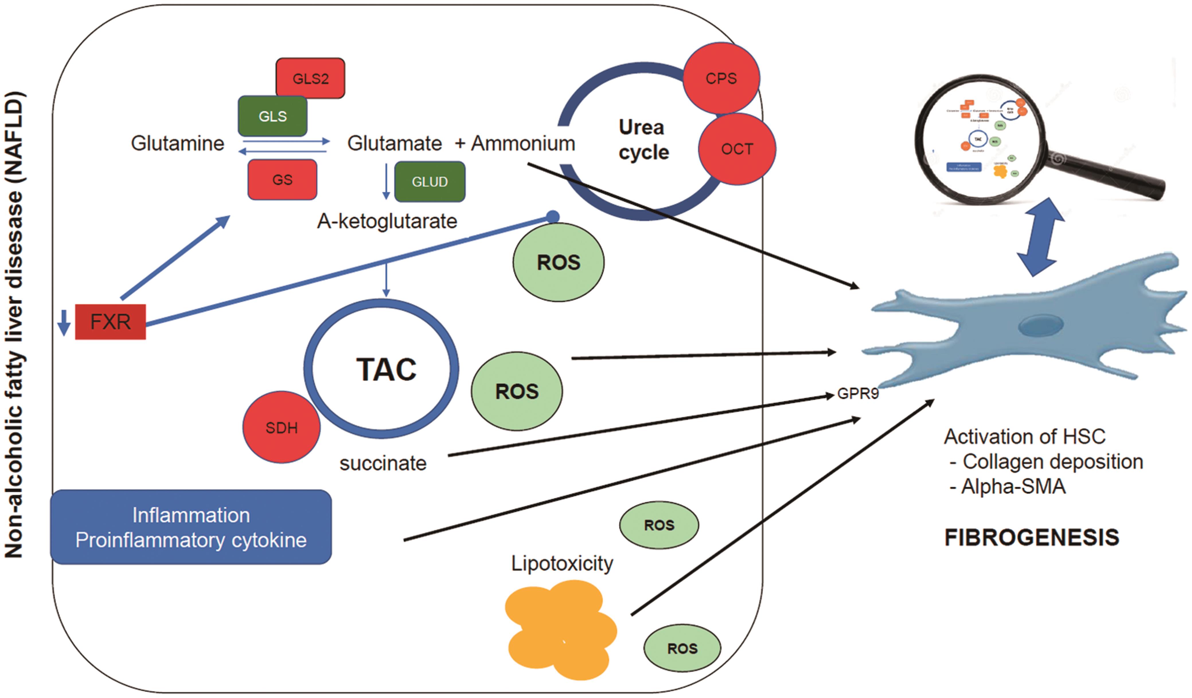 Glutamine metabolism pathway and its association with NASH-fibrogenesis.