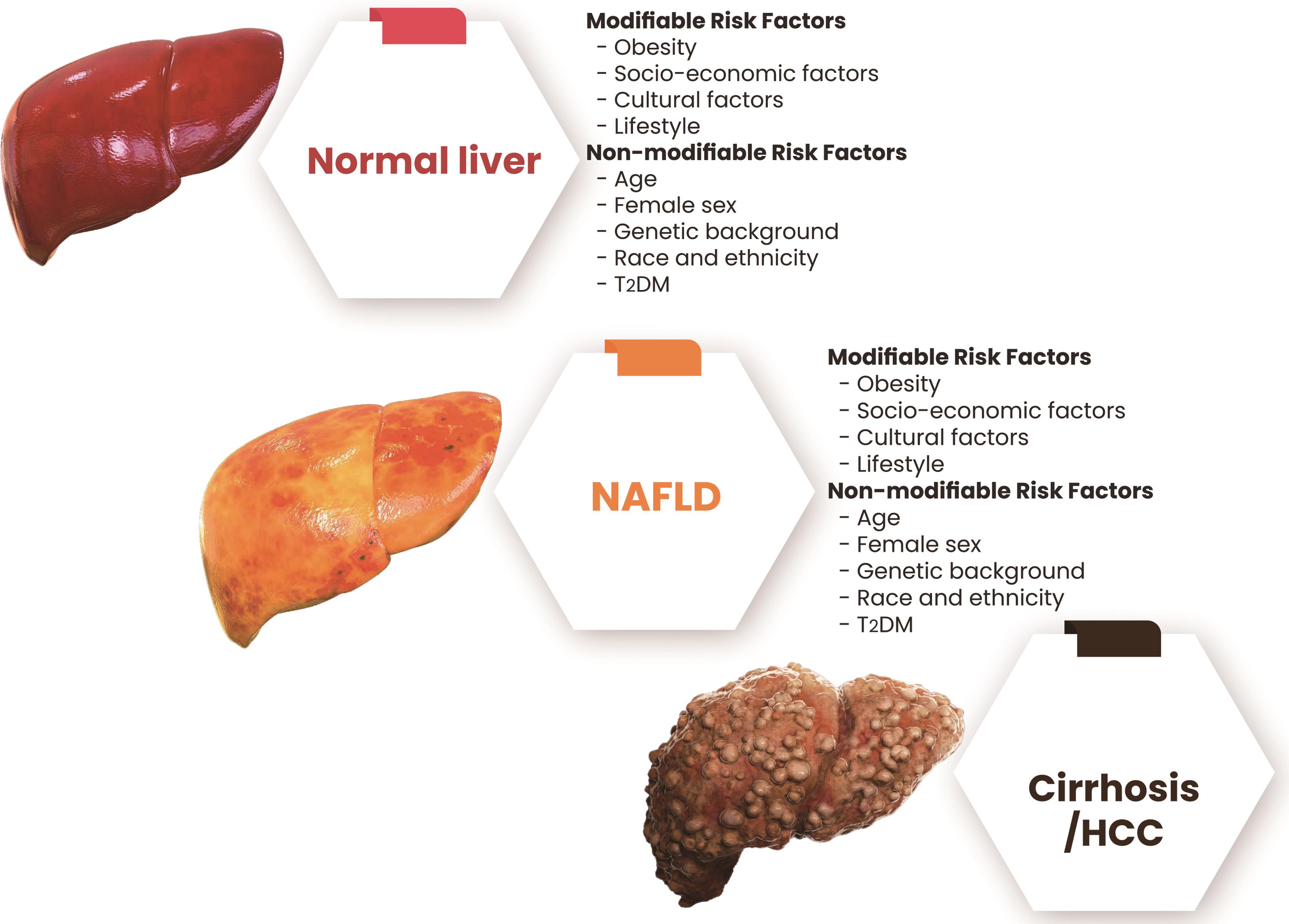 Recent Updates In The Prevention Of Nonalcoholic Fatty Liver Disease