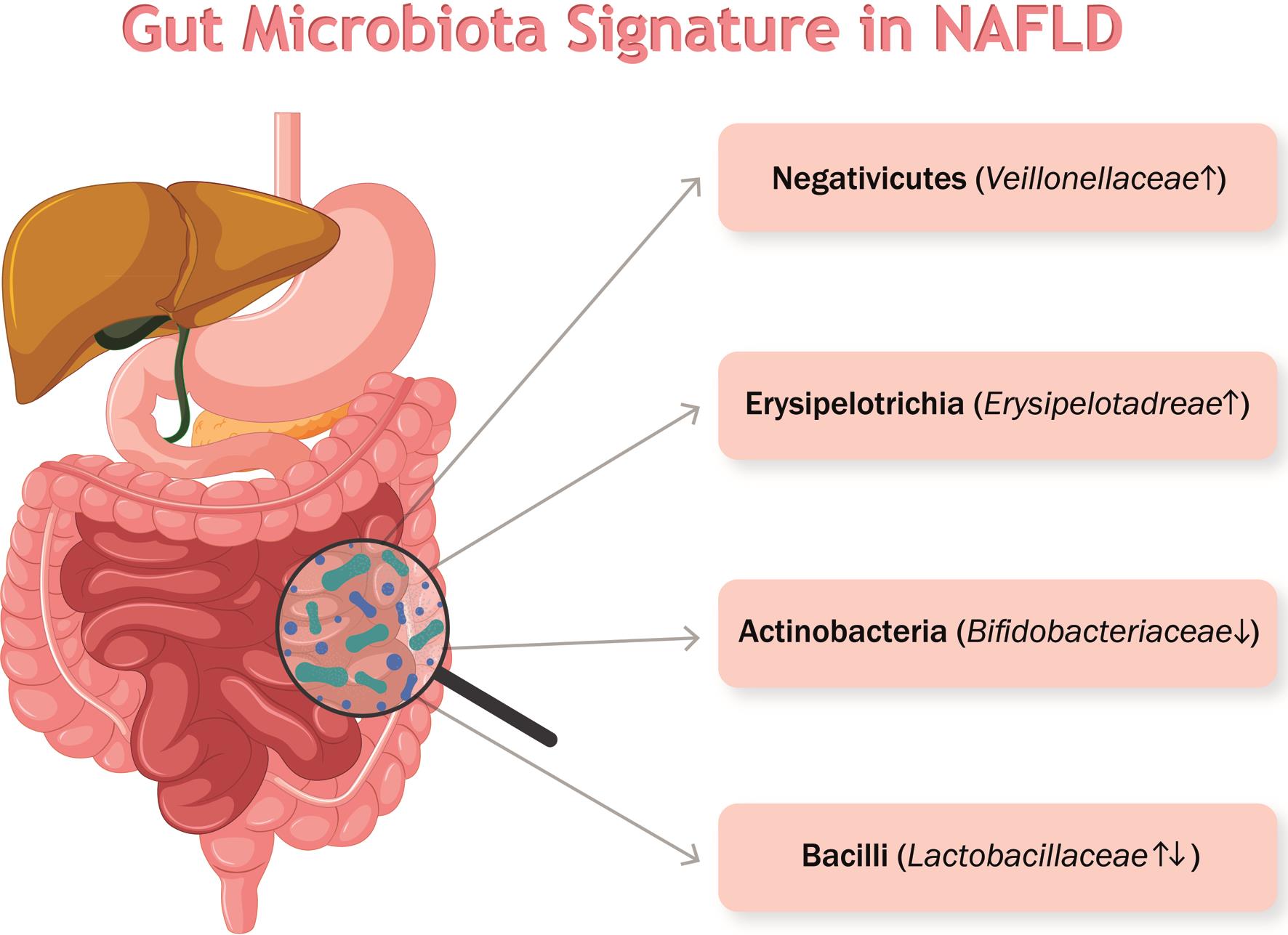 Gut microbiota signature in nonalcoholic fatty liver disease.