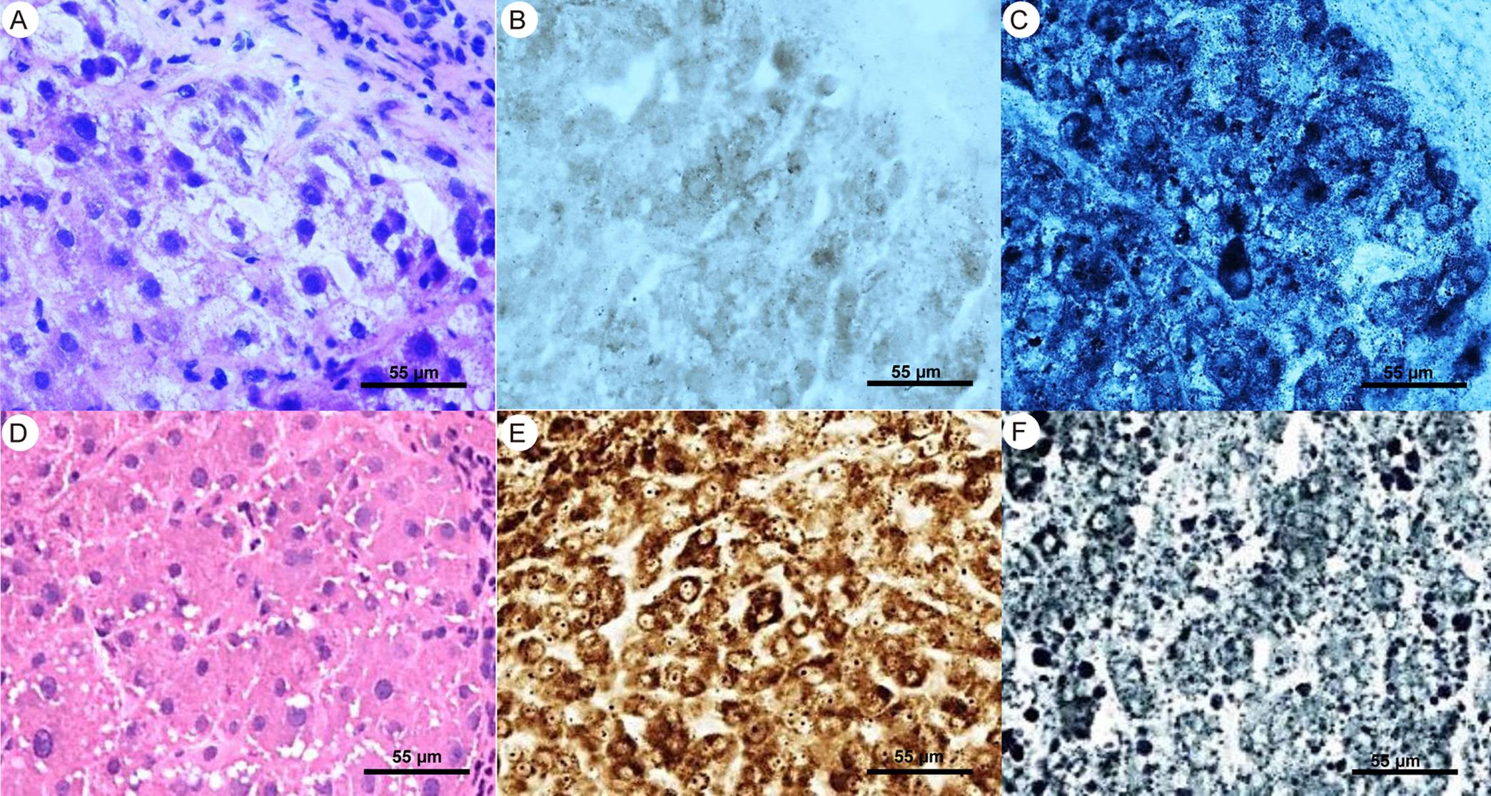 Serial cryostat sections of cryptogenic cirrhotic liver and normal liver specimens comparing histological and enzyme histochemical properties.