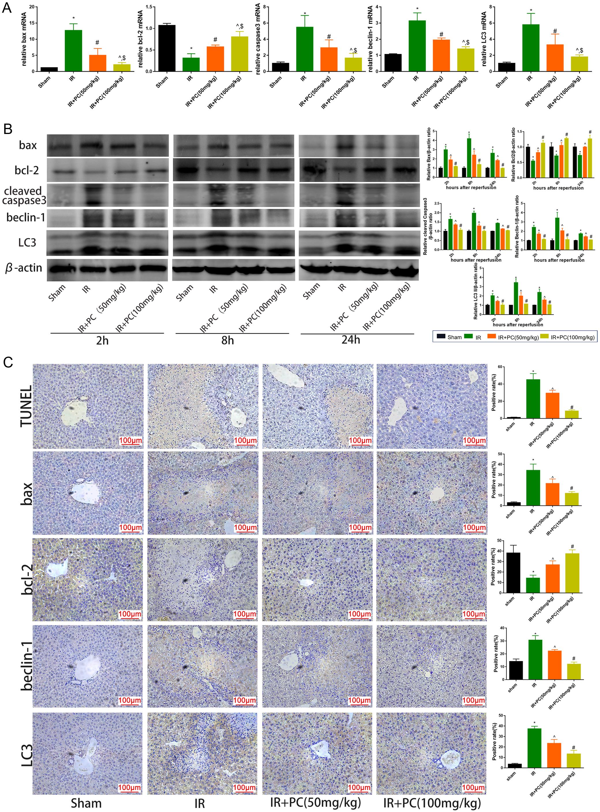 PC pretreatment attenuated hepatocyte apoptosis and autophagy during hepatic IRI in mice.